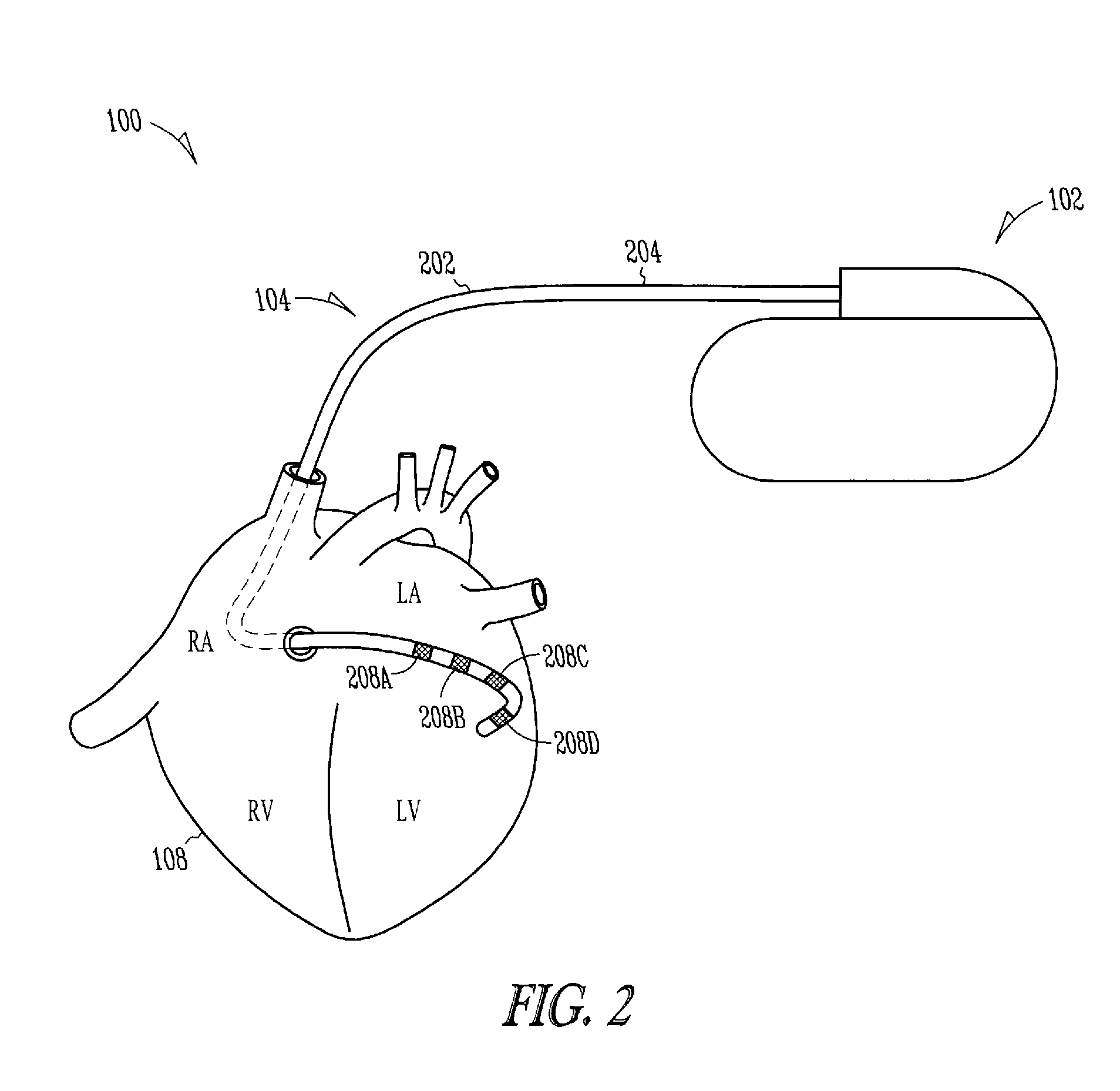 Lead with fibrous matrix coating and methods related thereto