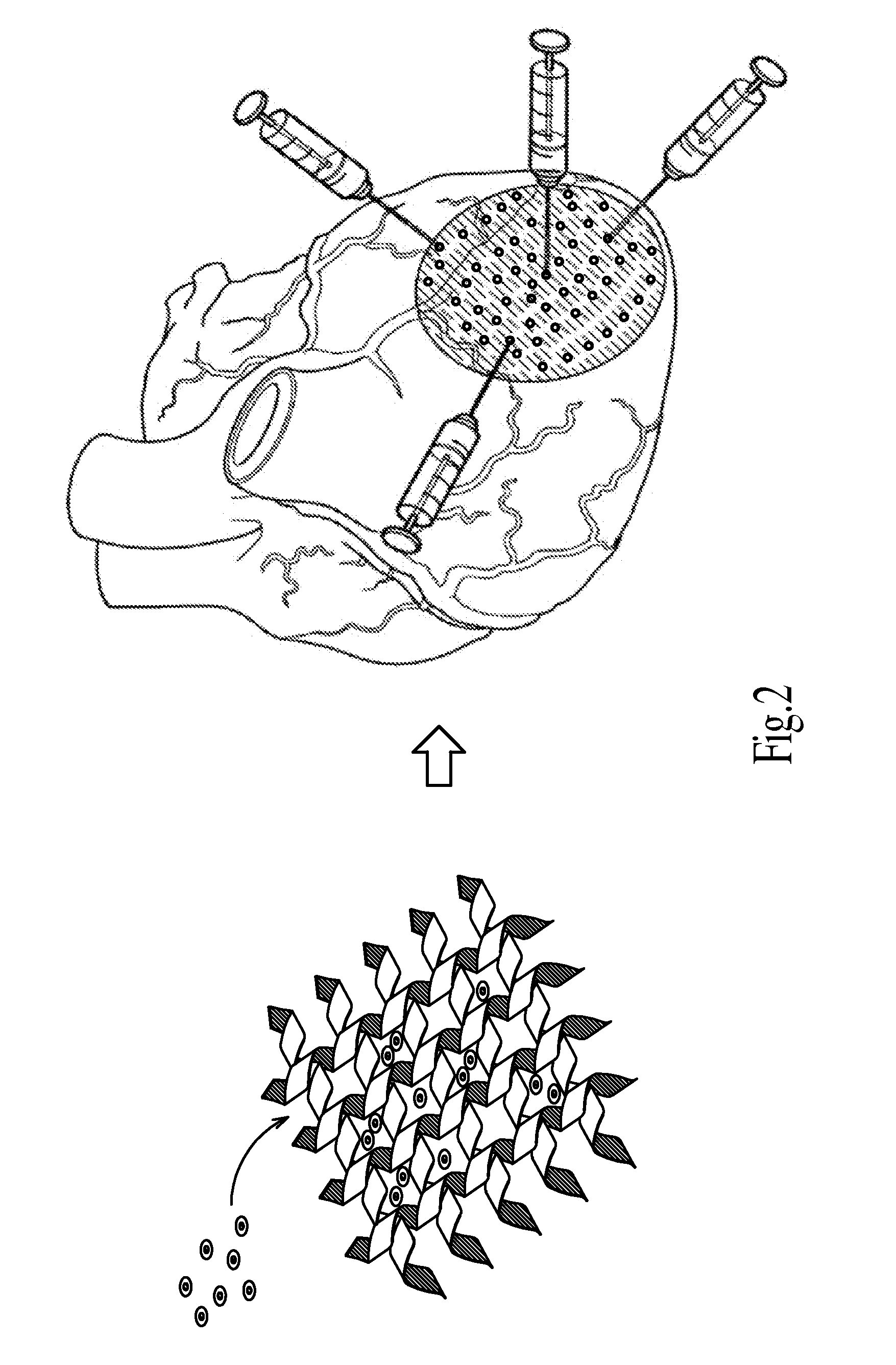 Method for improving myocardial infarction by intramyocardial or transendocardial injection of peptide nanofibers