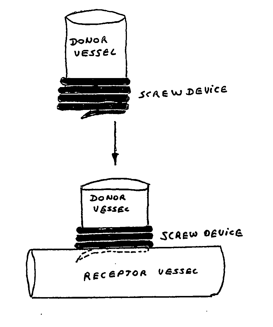 Screw-device for anastomosis