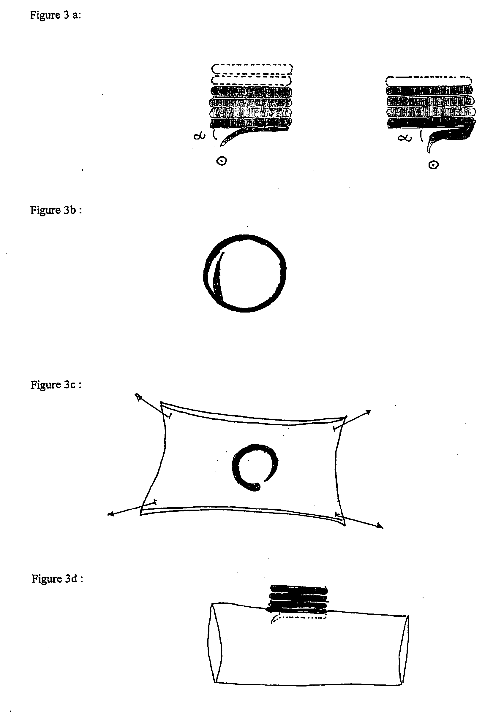 Screw-device for anastomosis