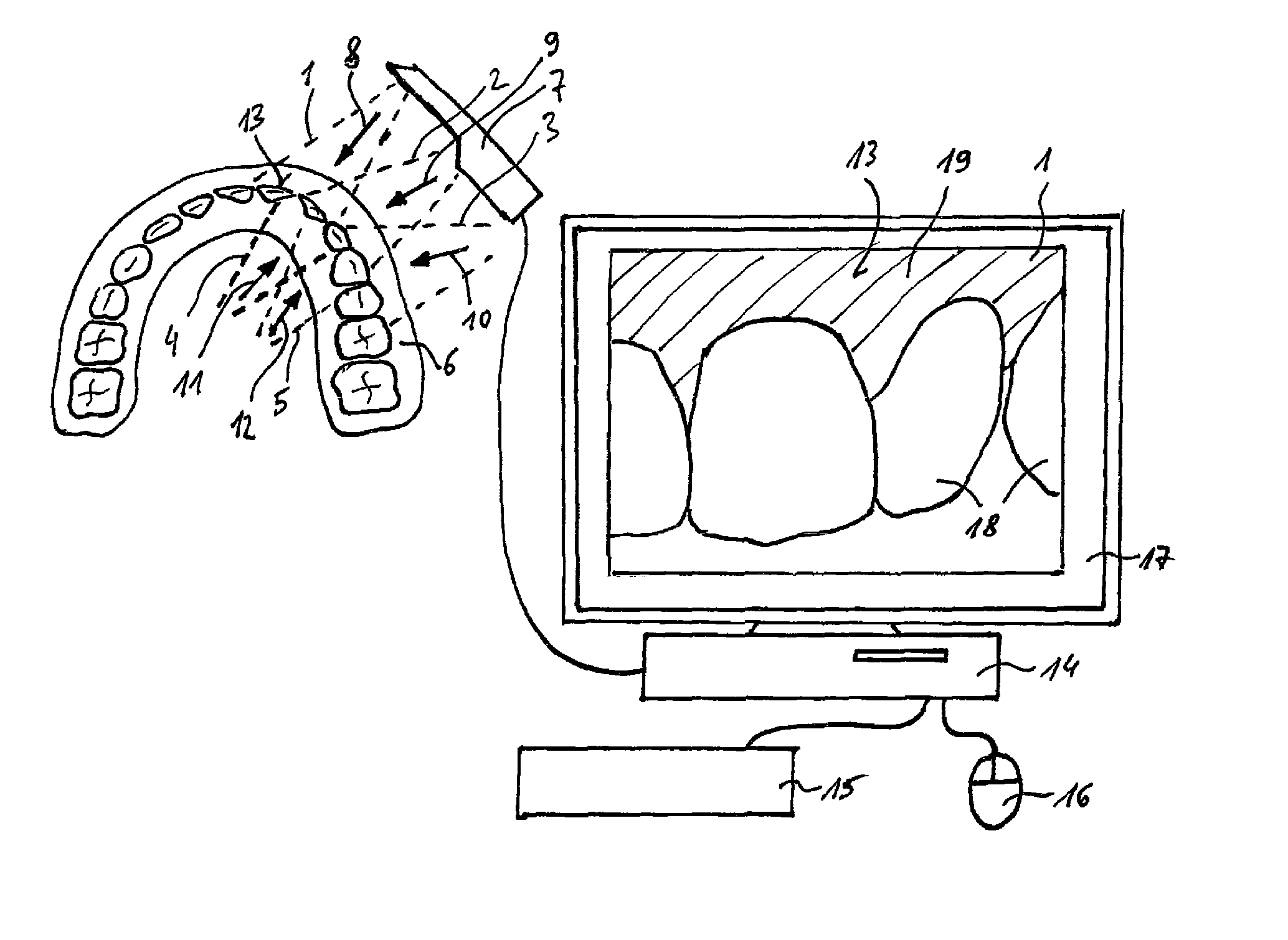 Method for recording multiple three-dimensional images of a dental object