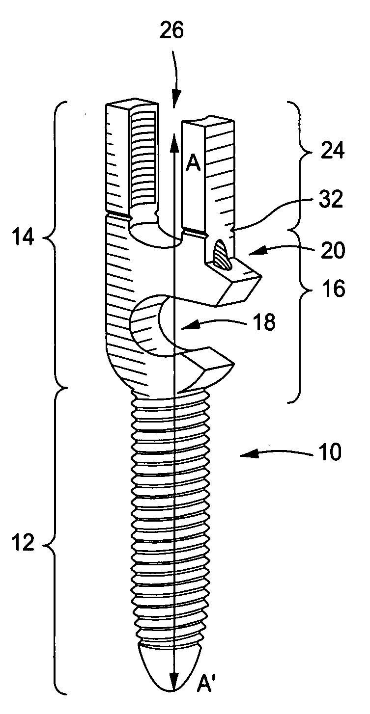 Spinal Rod Link Reducer