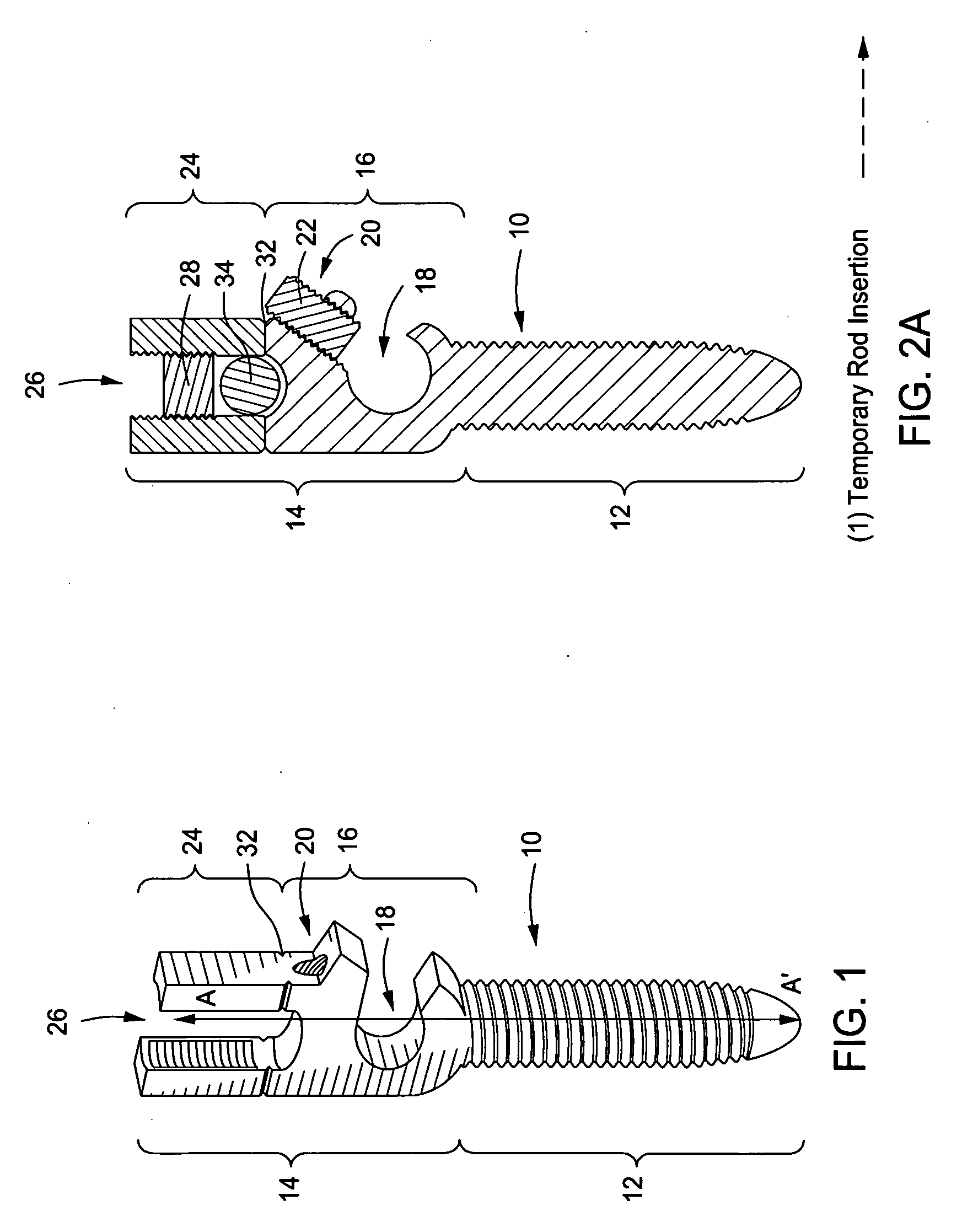 Spinal Rod Link Reducer