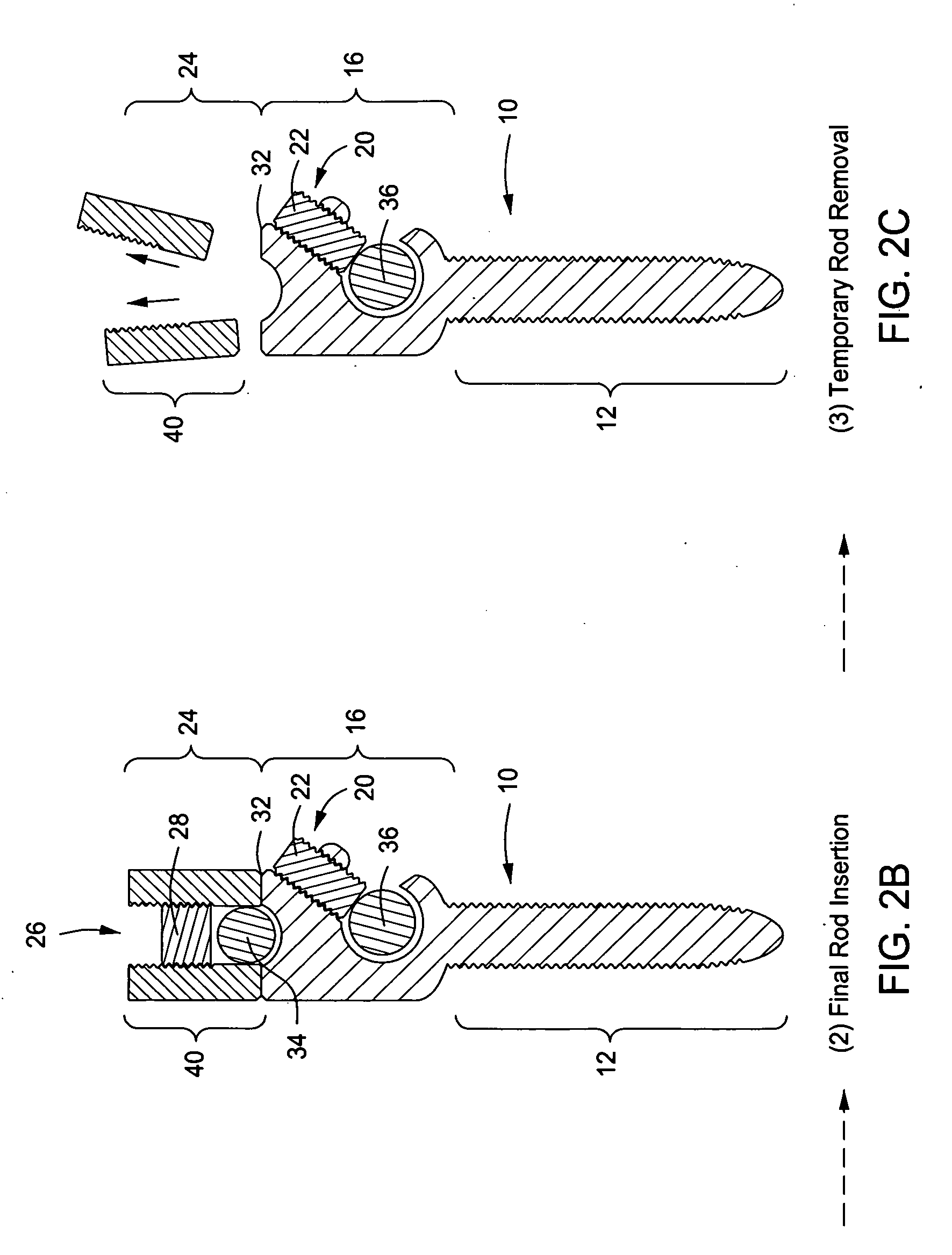 Spinal Rod Link Reducer