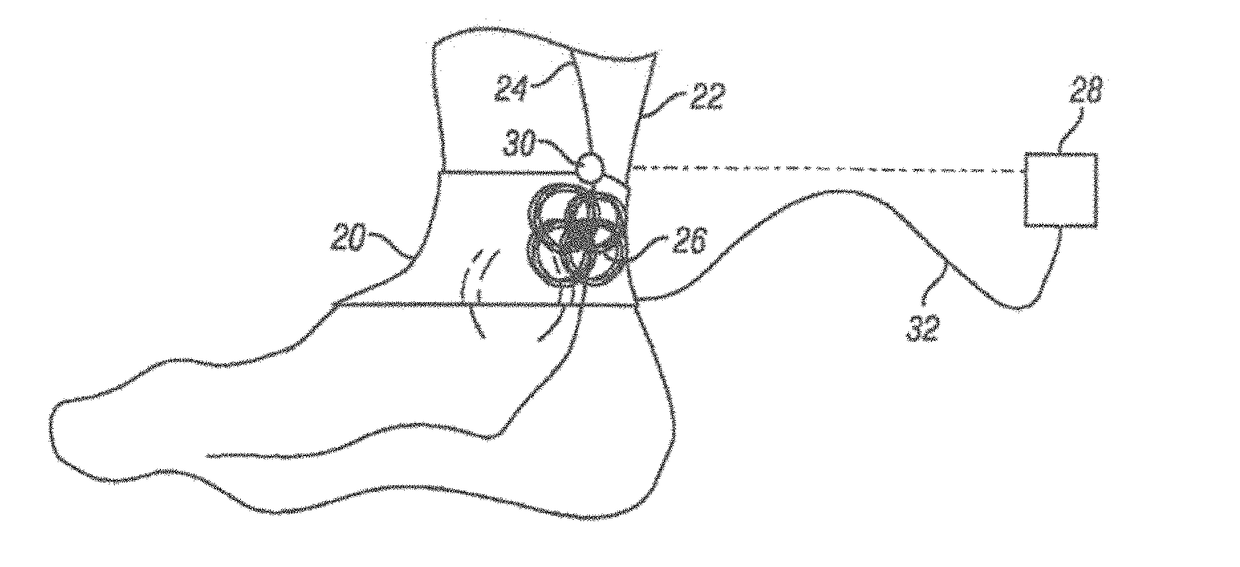 Method and apparatus for transdermal stimulation over the palmar and plantar surfaces