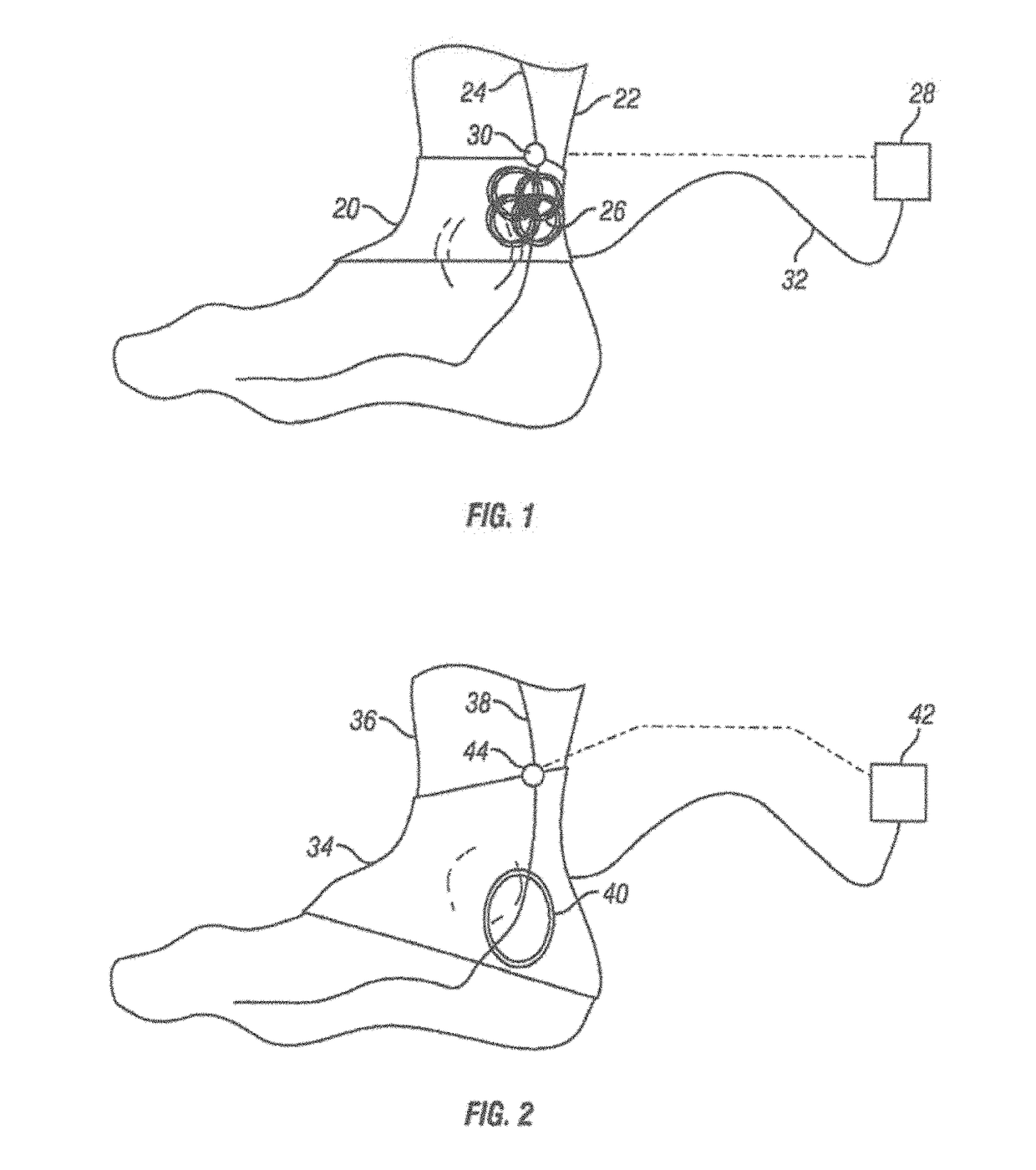 Method and apparatus for transdermal stimulation over the palmar and plantar surfaces