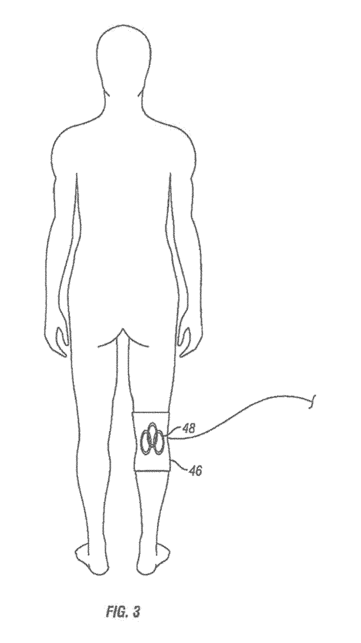 Method and apparatus for transdermal stimulation over the palmar and plantar surfaces