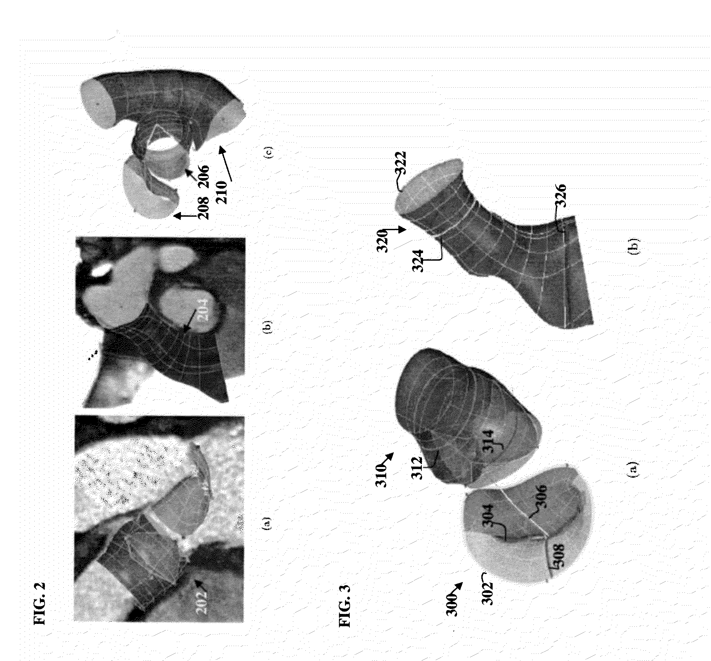 Method and System for Medical Decision Support Using Organ Models and Learning Based Discriminative Distance Functions