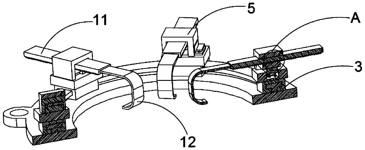 Retractor for gynecological surgery