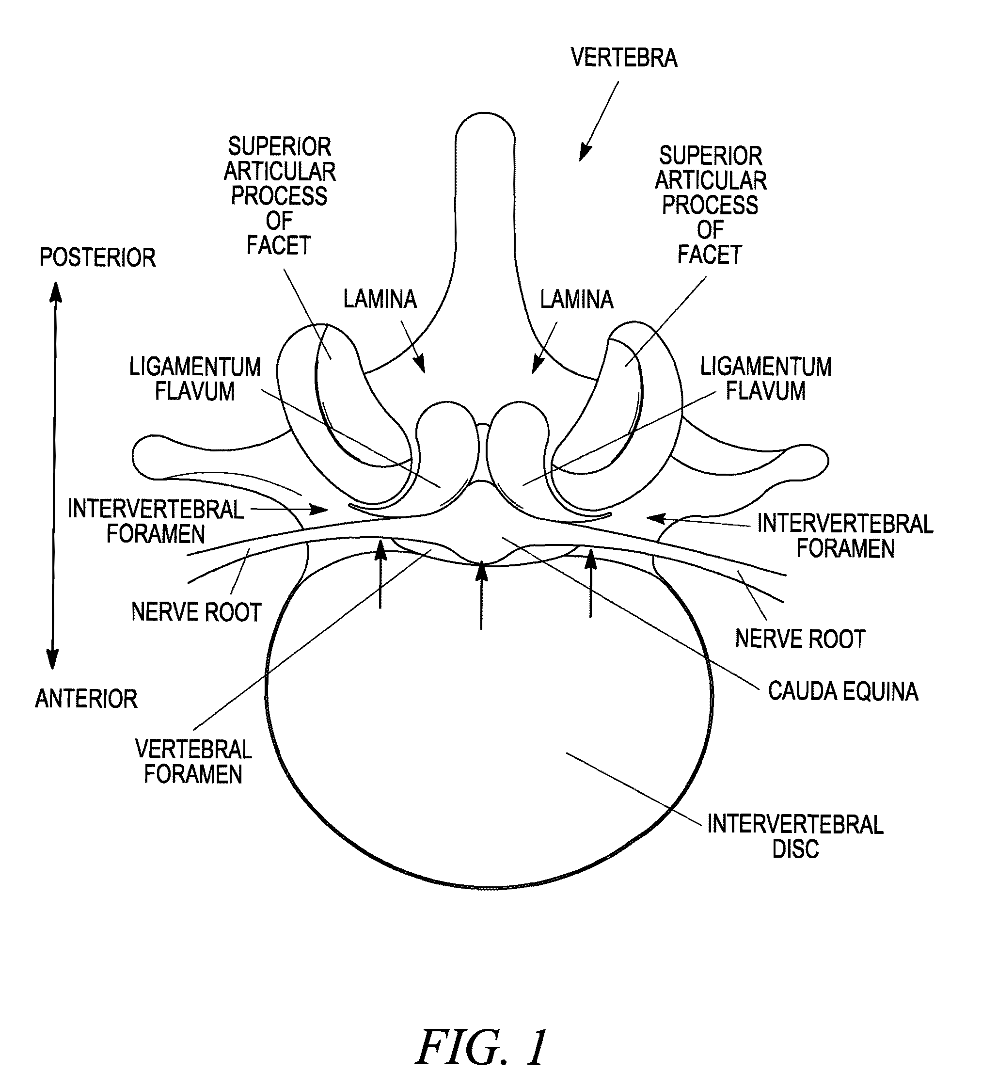 Spinal access and neural localization