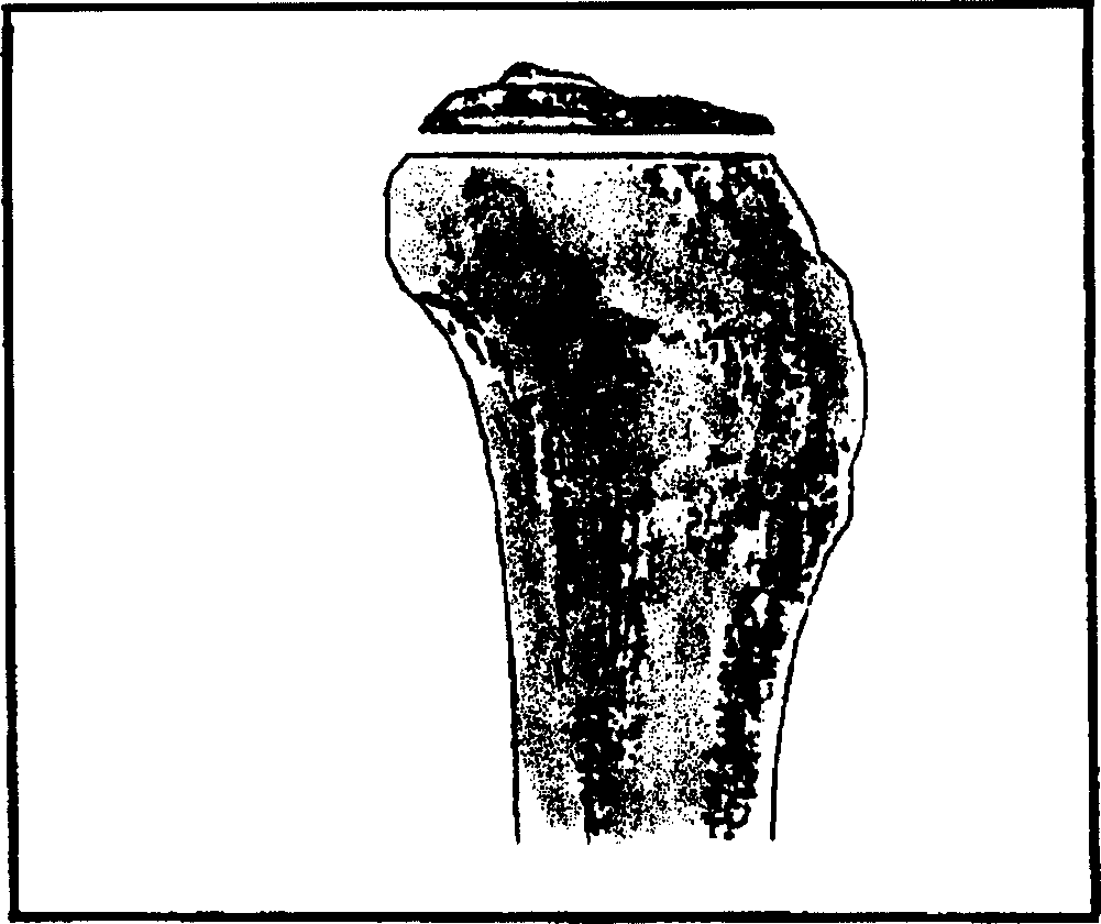 Femur formation and cutting center