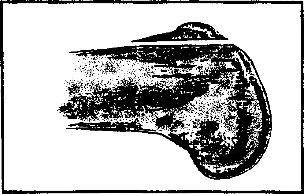 Femur formation and cutting center