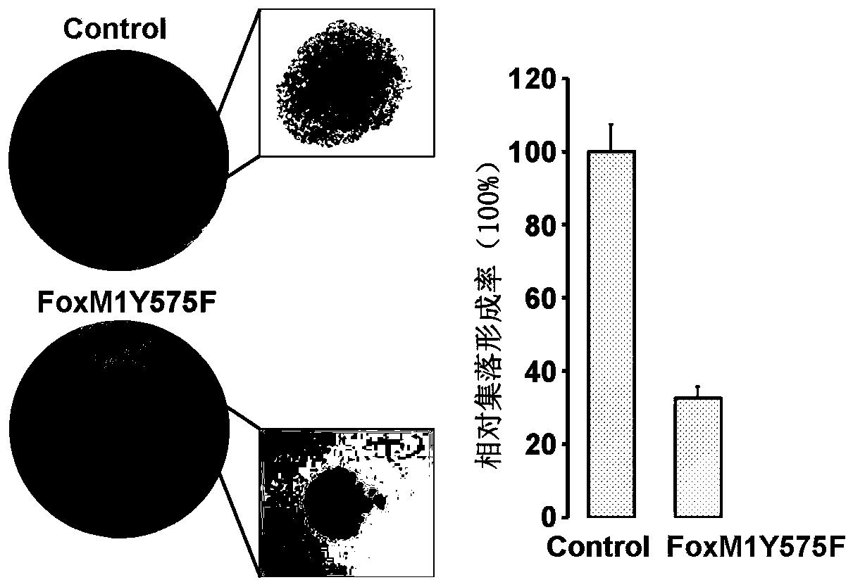 Application of c-Abl kinase inhibitor in FoxM1 high-expression tumor treatment