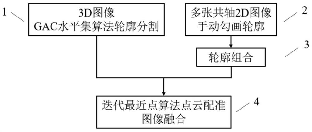 2D image and 3D image registration method based on contour features