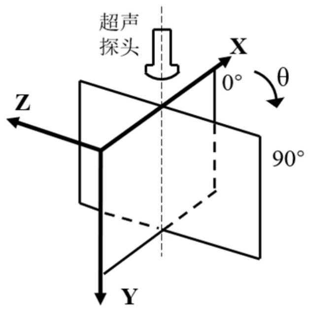 2D image and 3D image registration method based on contour features