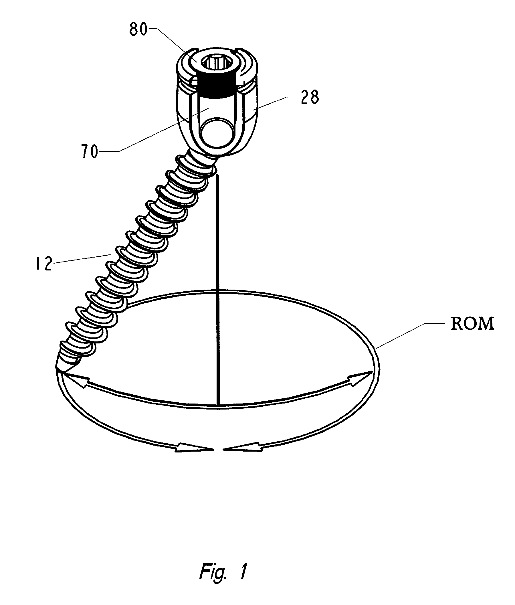 Top loading polyaxial ball and socket fastener