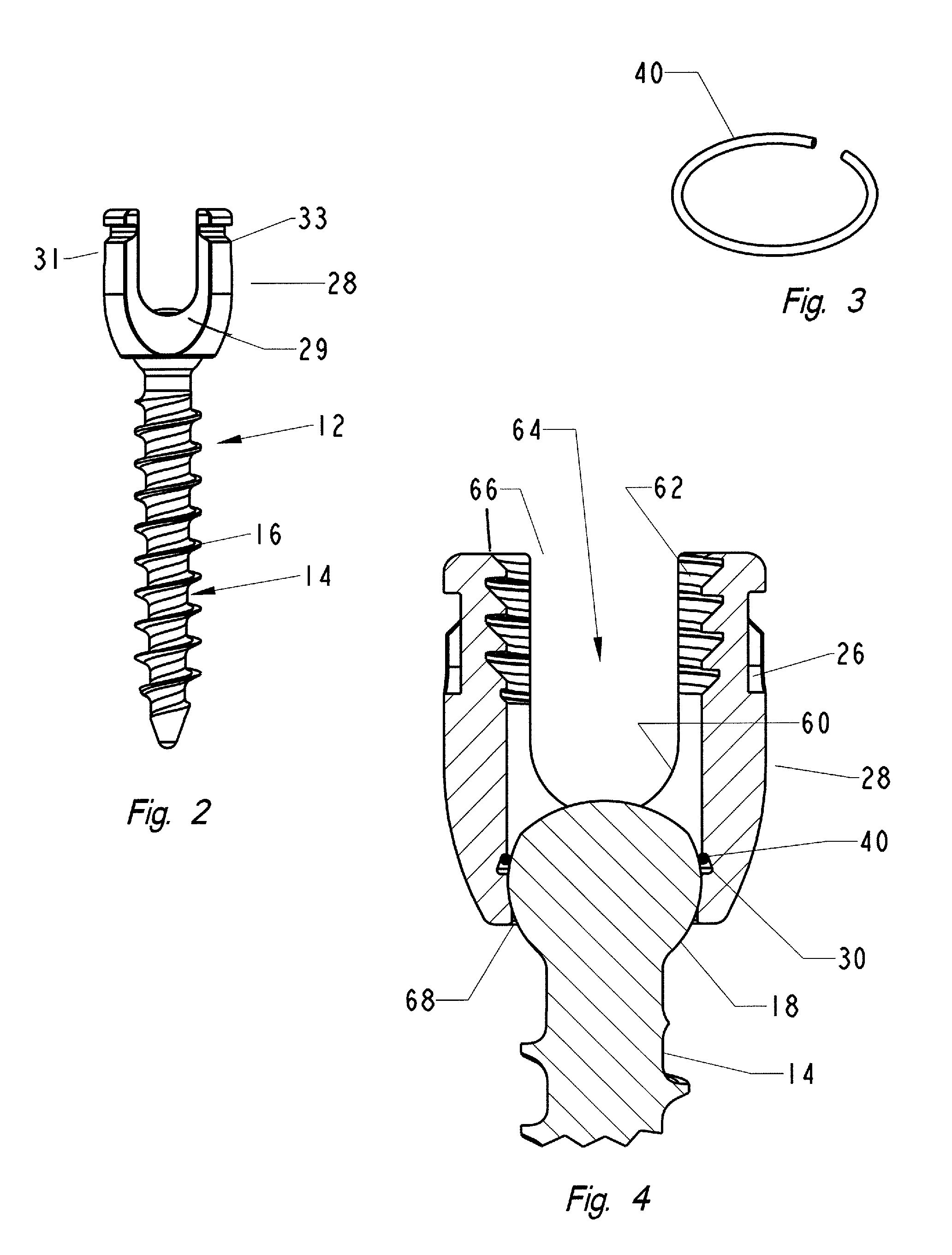 Top loading polyaxial ball and socket fastener