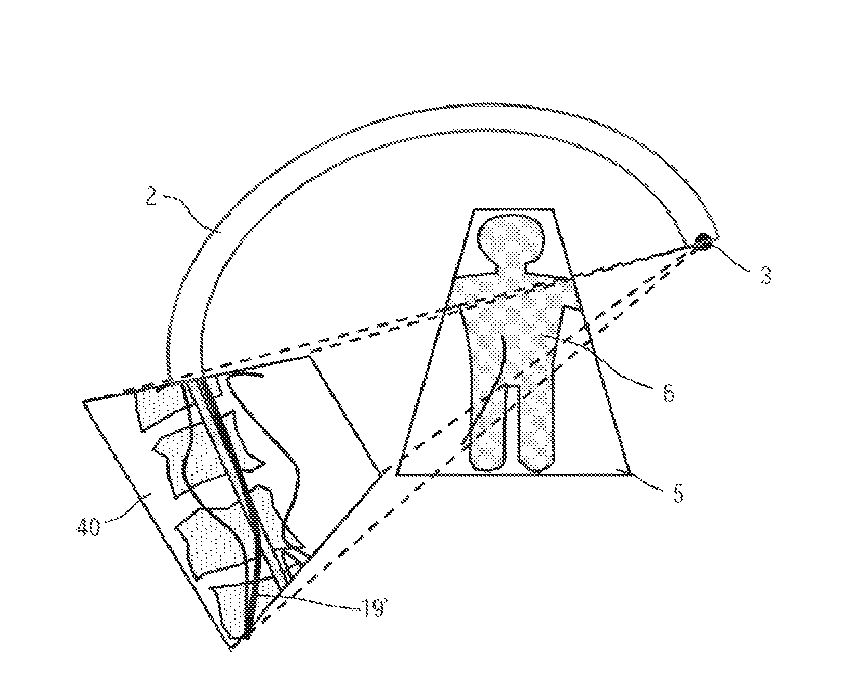 Angiographic Examination Method for a Vascular System