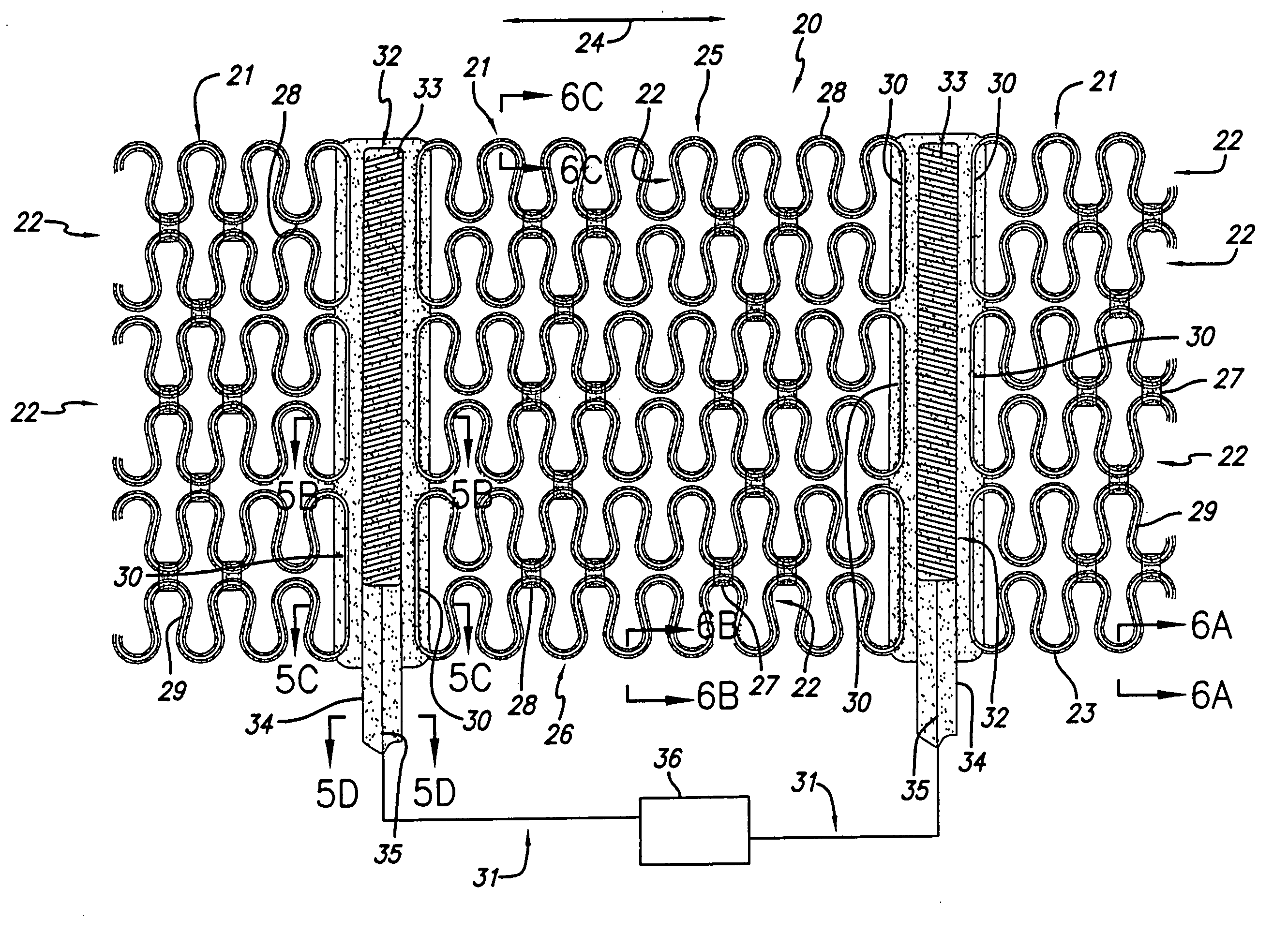 Cardiac harness having diagnostic sensors and method of use