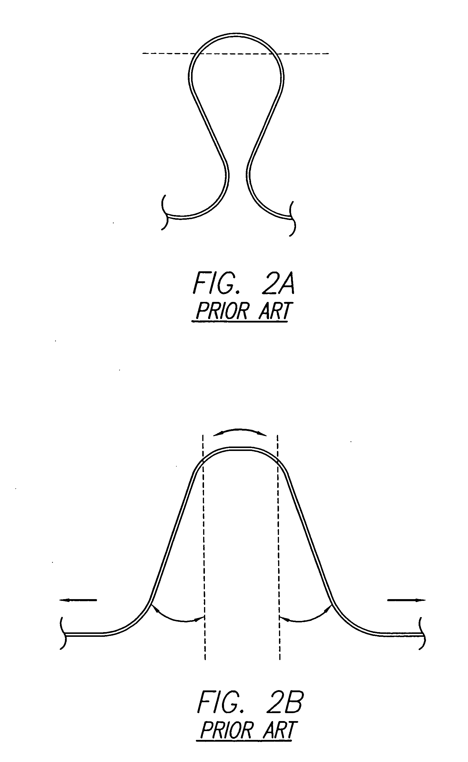 Cardiac harness having diagnostic sensors and method of use