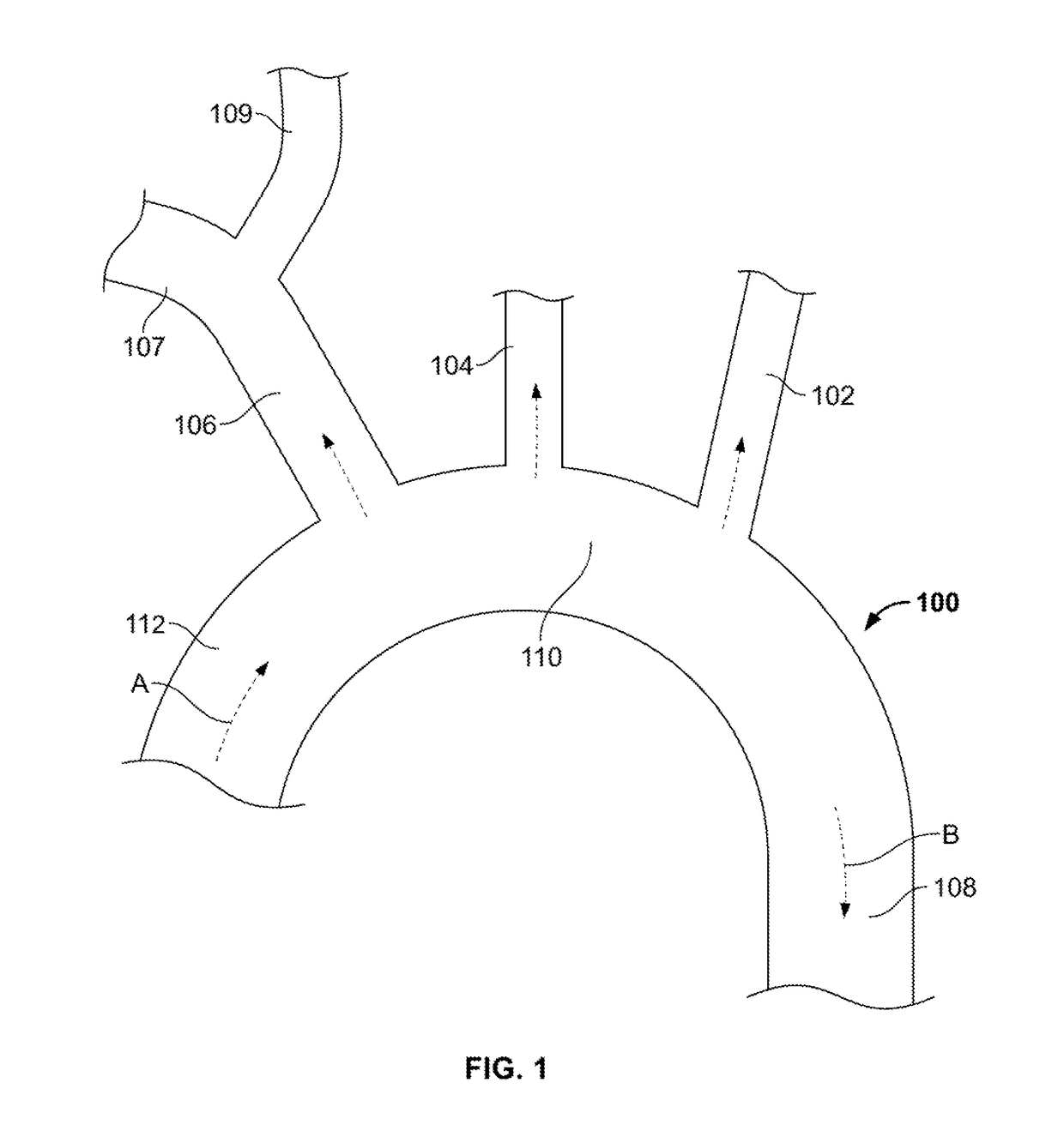 Embolic protection device