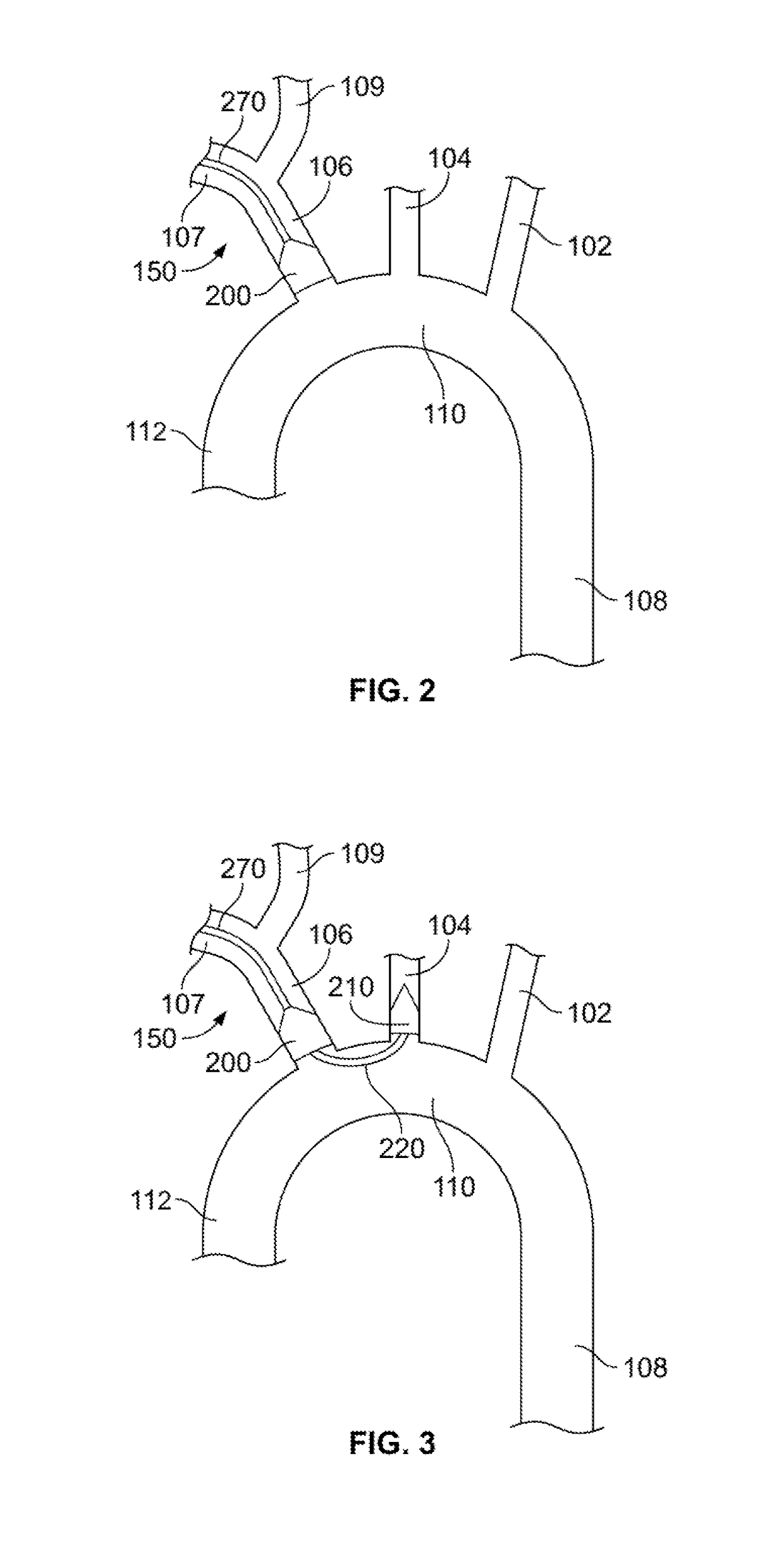 Embolic protection device