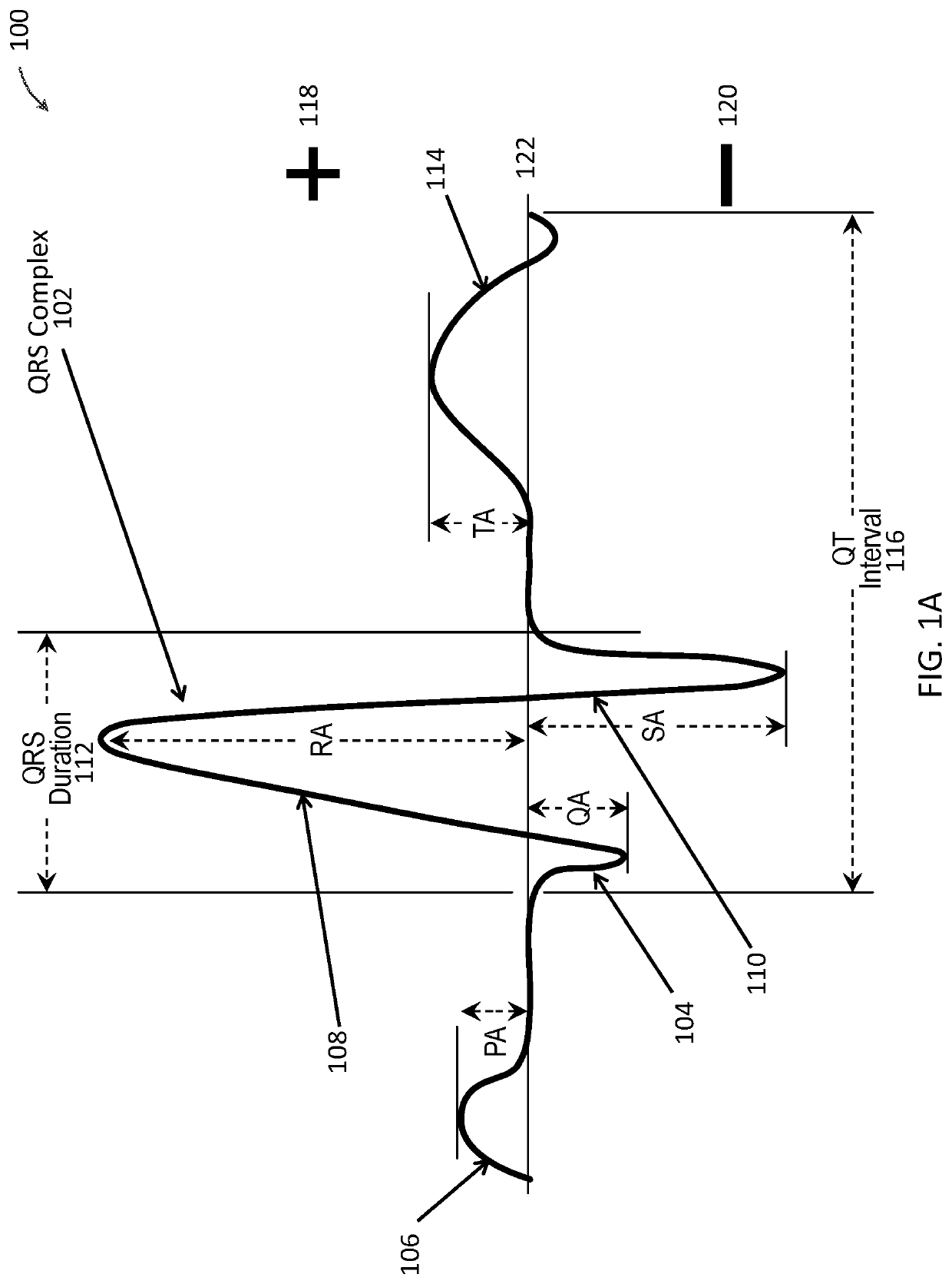 Apparatus and method for distinguishing wide complex heart beats