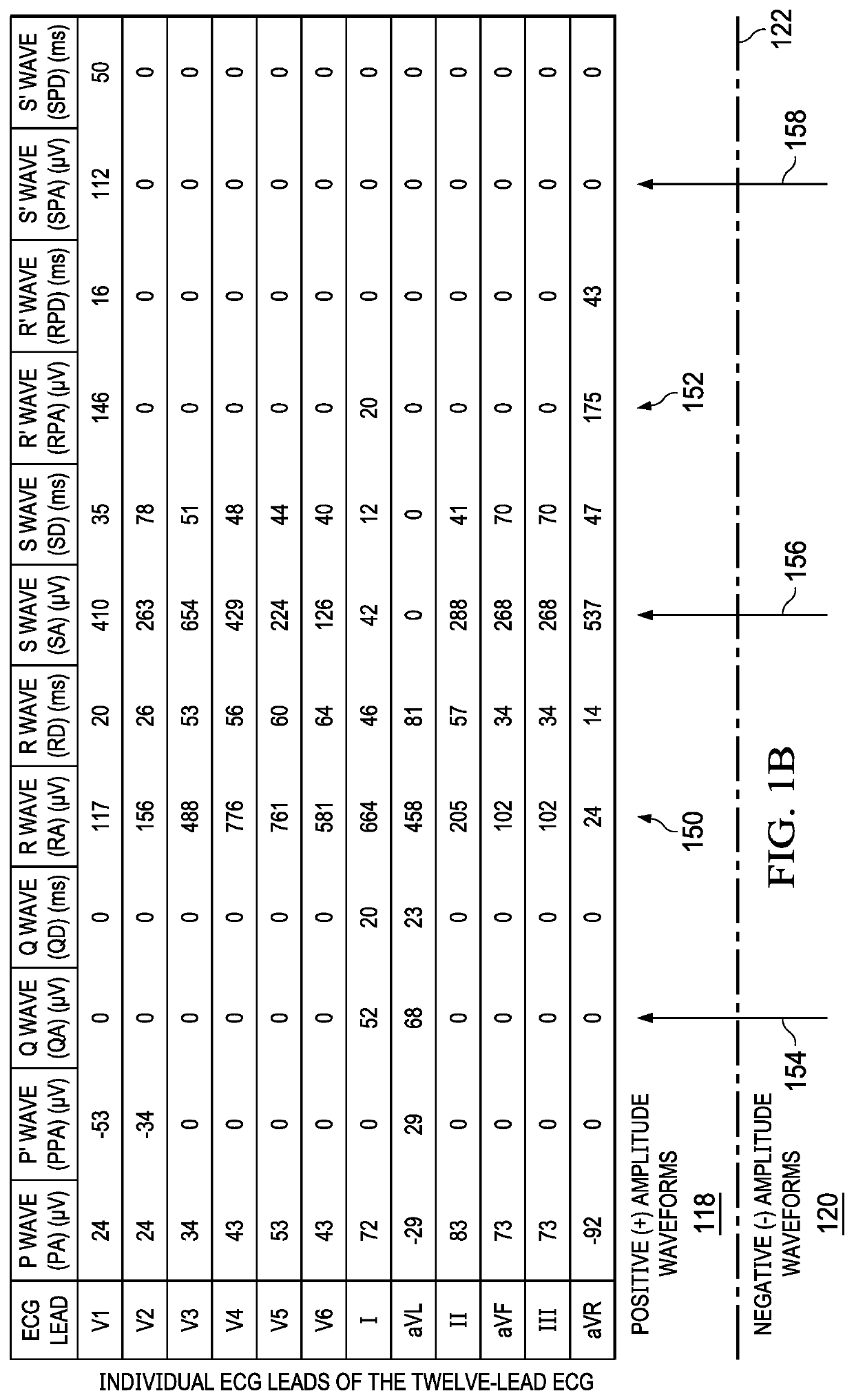 Apparatus and method for distinguishing wide complex heart beats