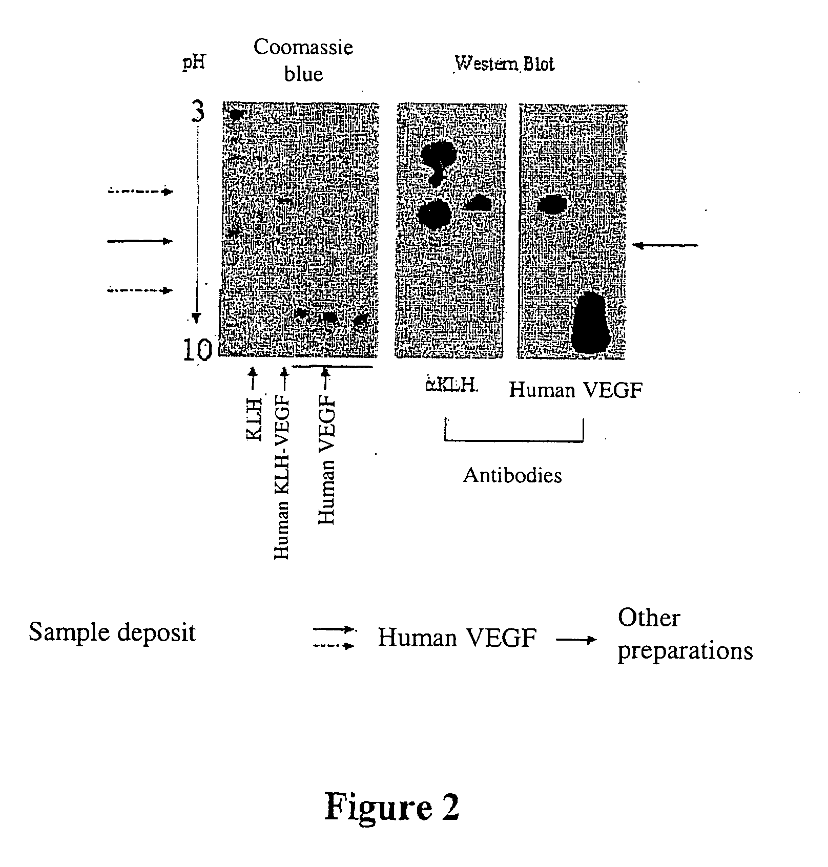 Stable immunogenic product comprising antigenic heterocomplexes