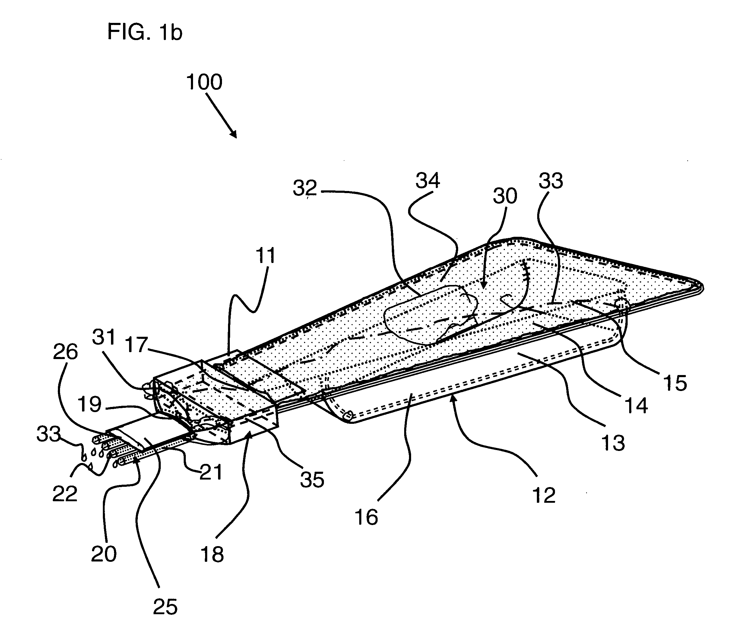 Direct delivery applicator assembly and method of use