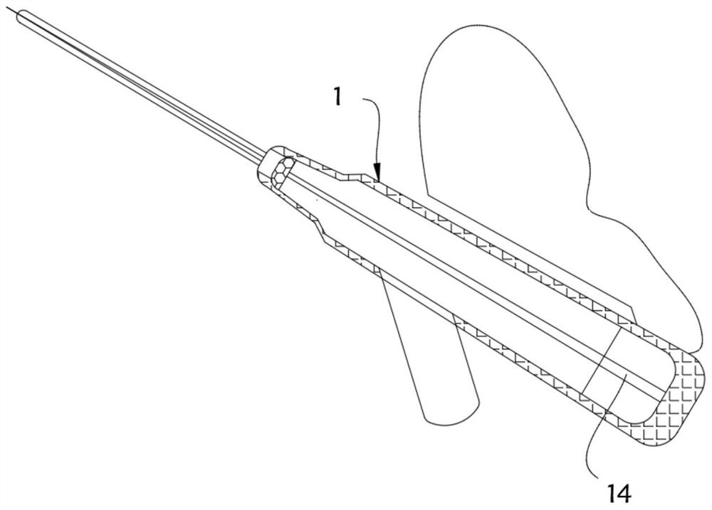 A multifunctional indwelling needle