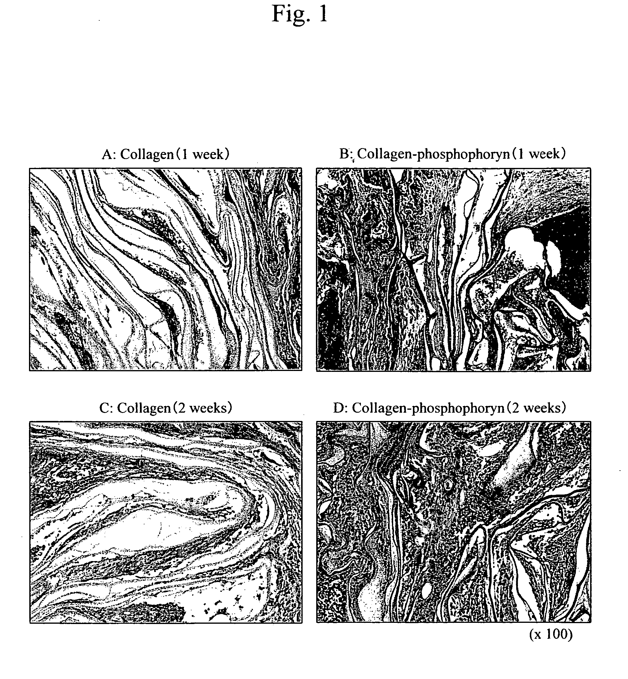 Periodontal tissue regeneration using composite materials comprising phosphophoryn