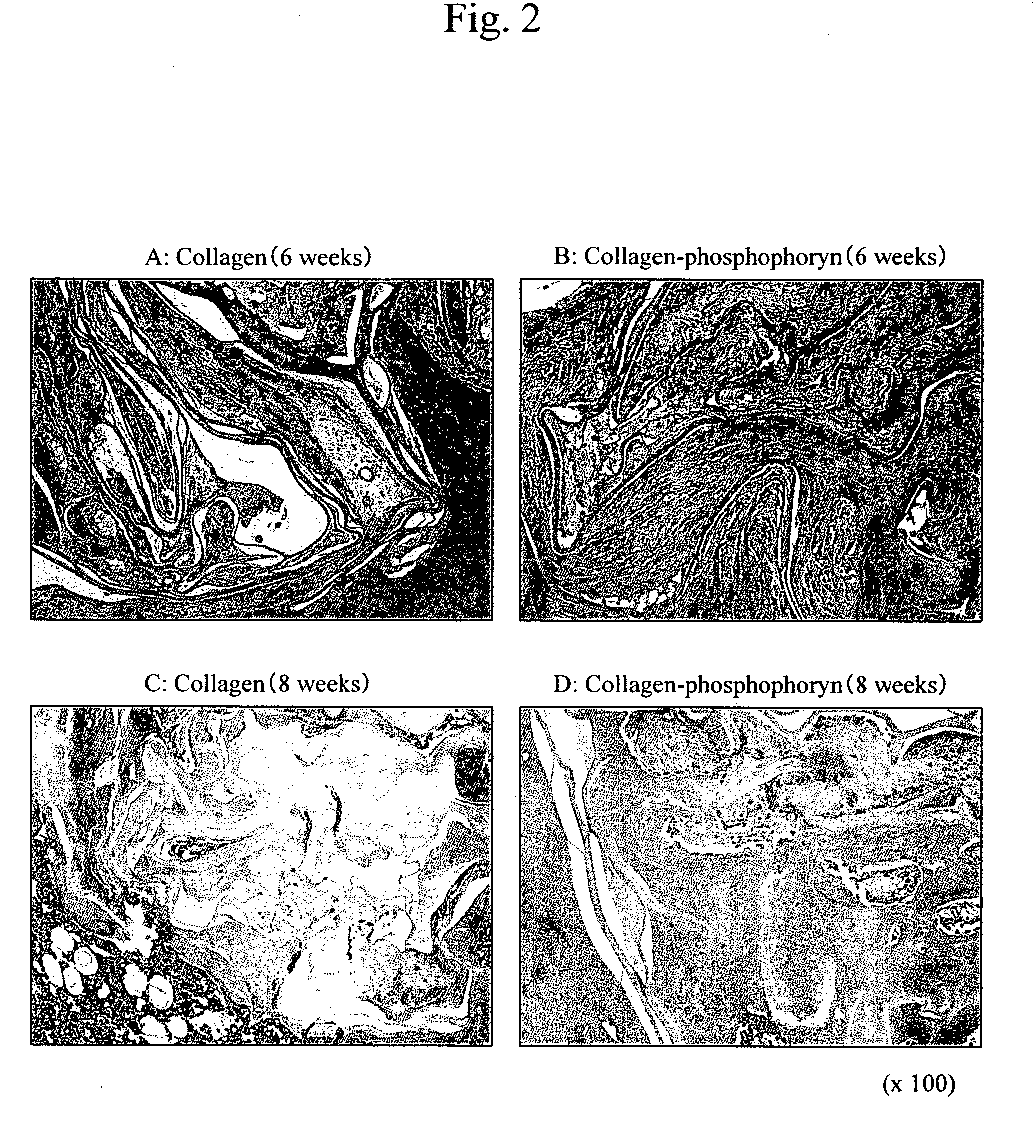 Periodontal tissue regeneration using composite materials comprising phosphophoryn