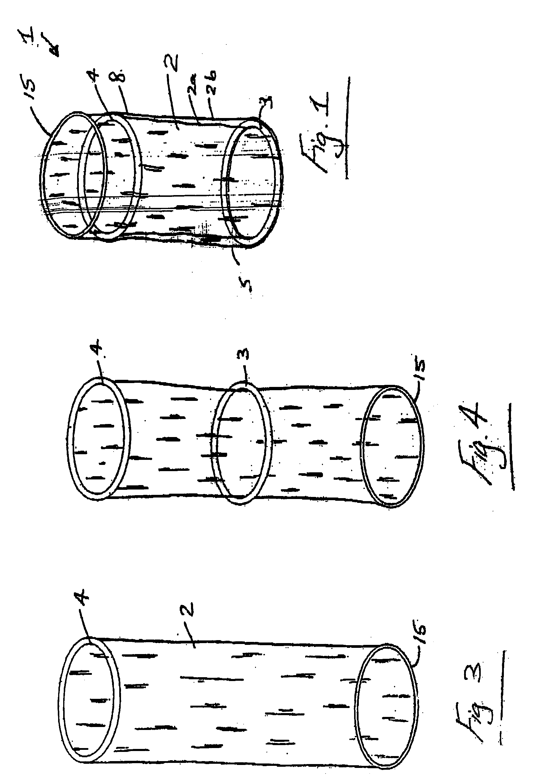 Wound retractor device