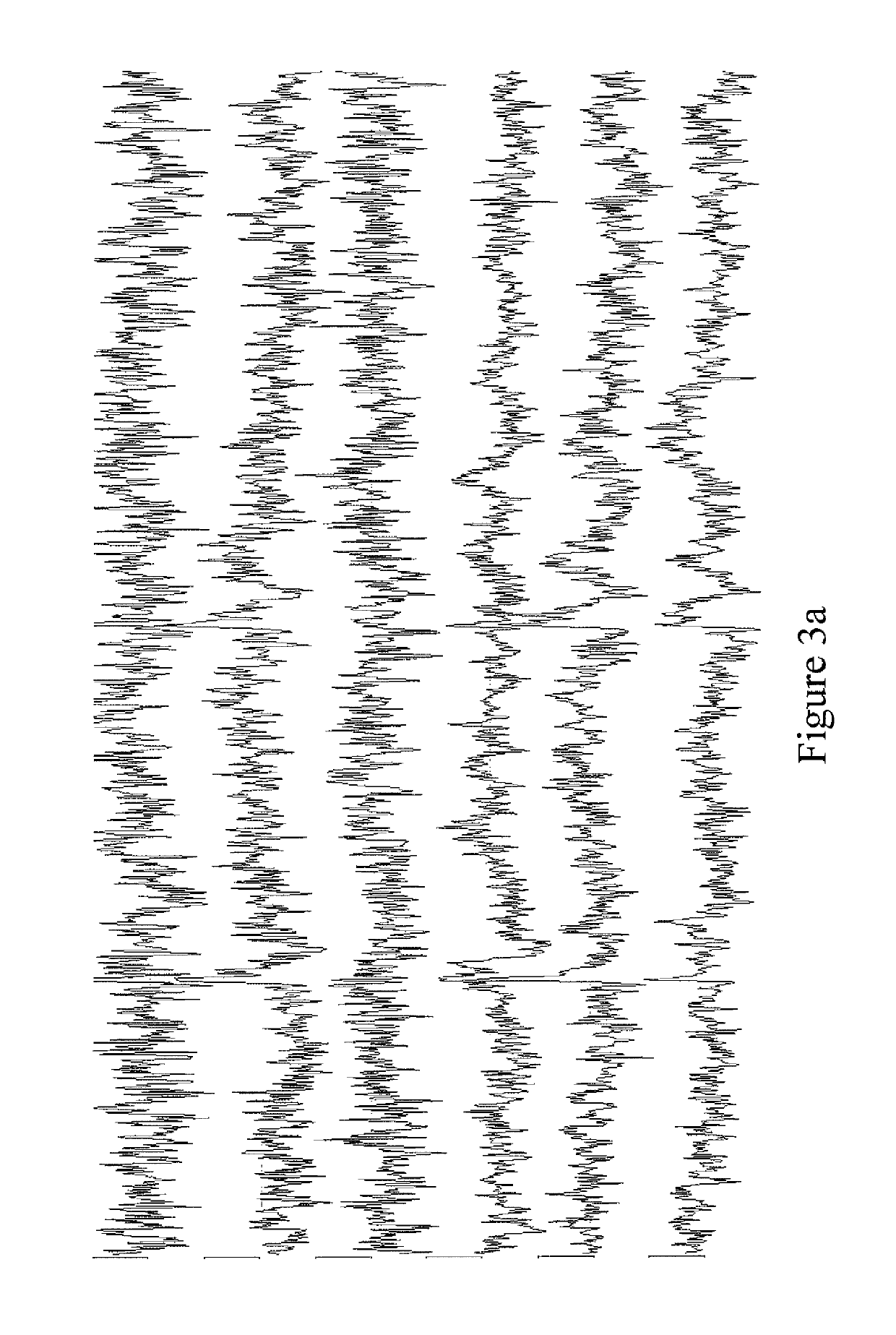 Method and device for recognizing and removing undesired artifacts in multichannel magnetic field or electric potential measurements