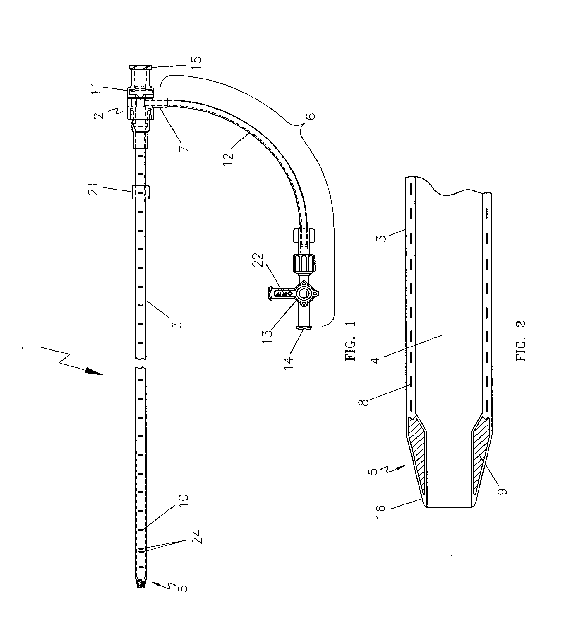 Endovascular Treatment Apparatus and Method