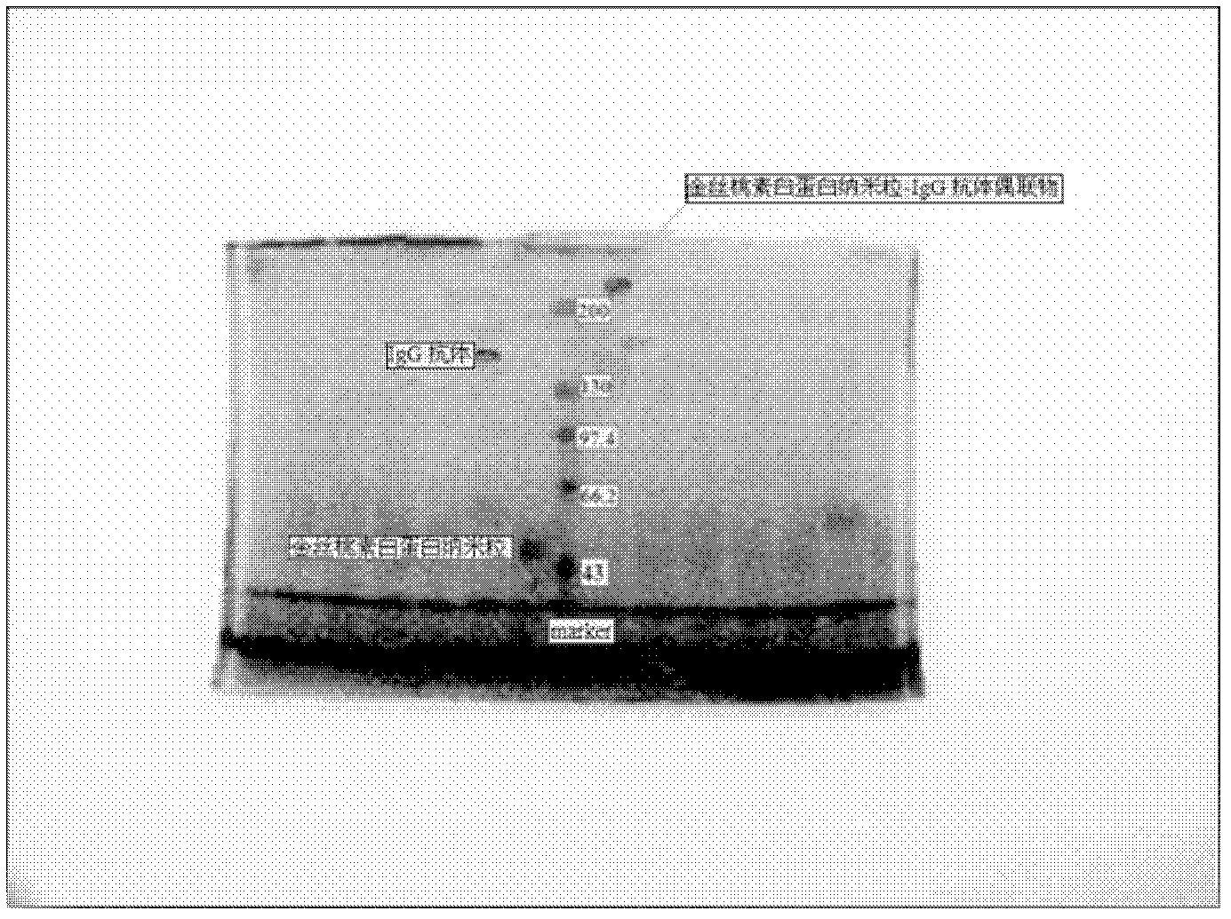 Hypericin albumin nanoparticle-immune globulin G antibody conjugate and preparation method thereof