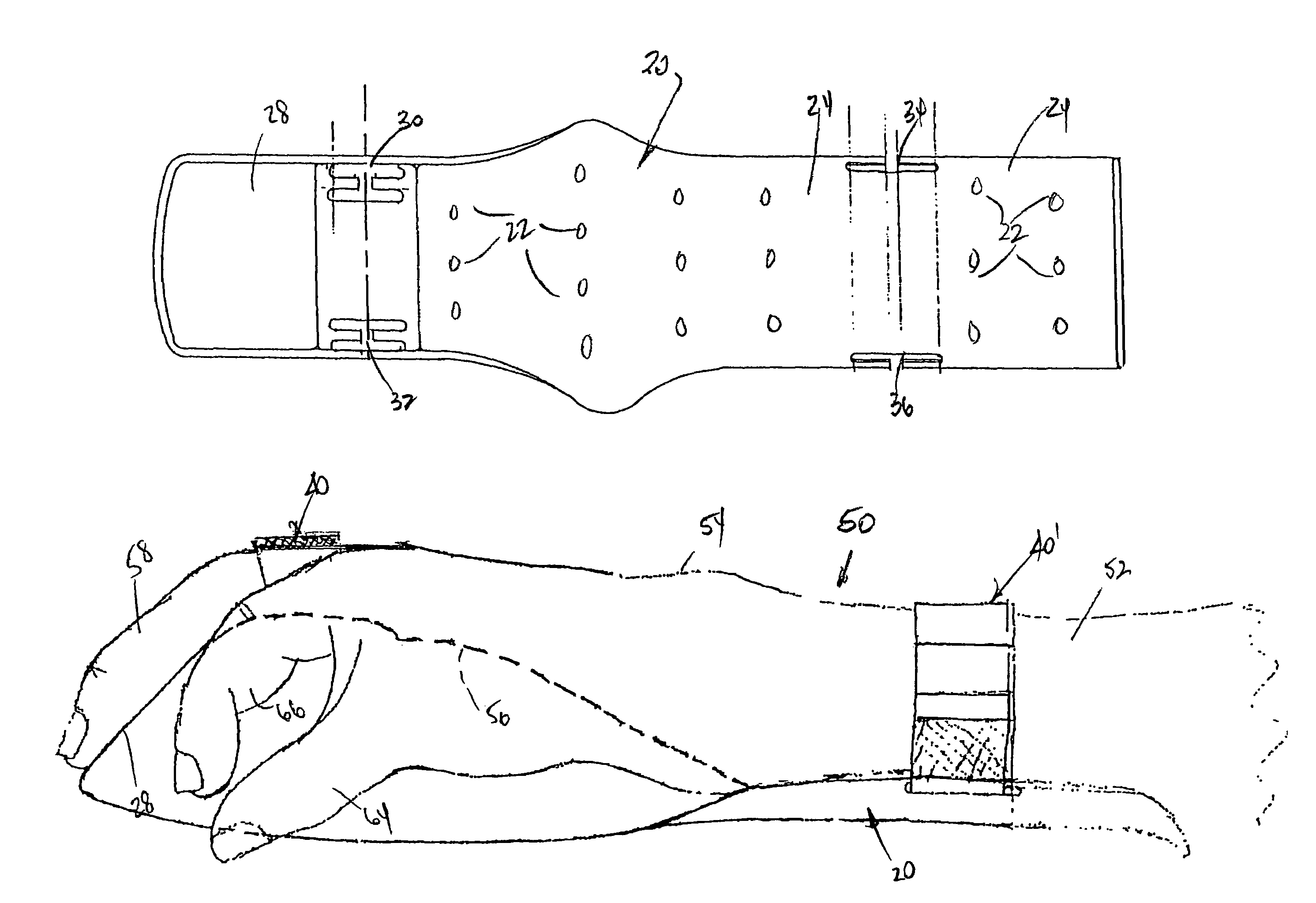 Universal intravenous arm support