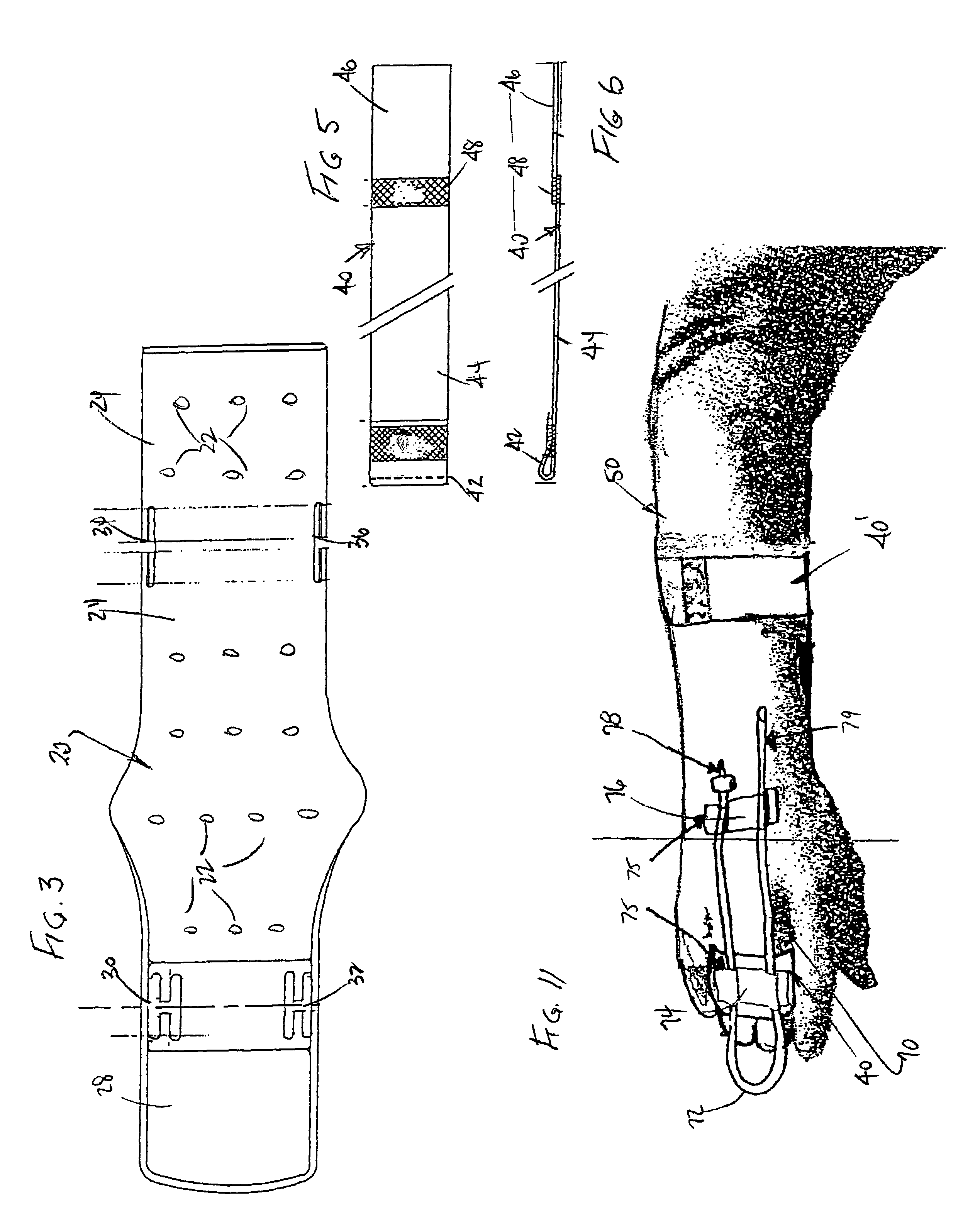 Universal intravenous arm support