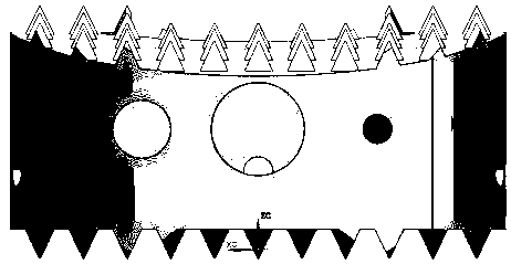 An absorbable cervical intervertebral fusion device and its preparation method