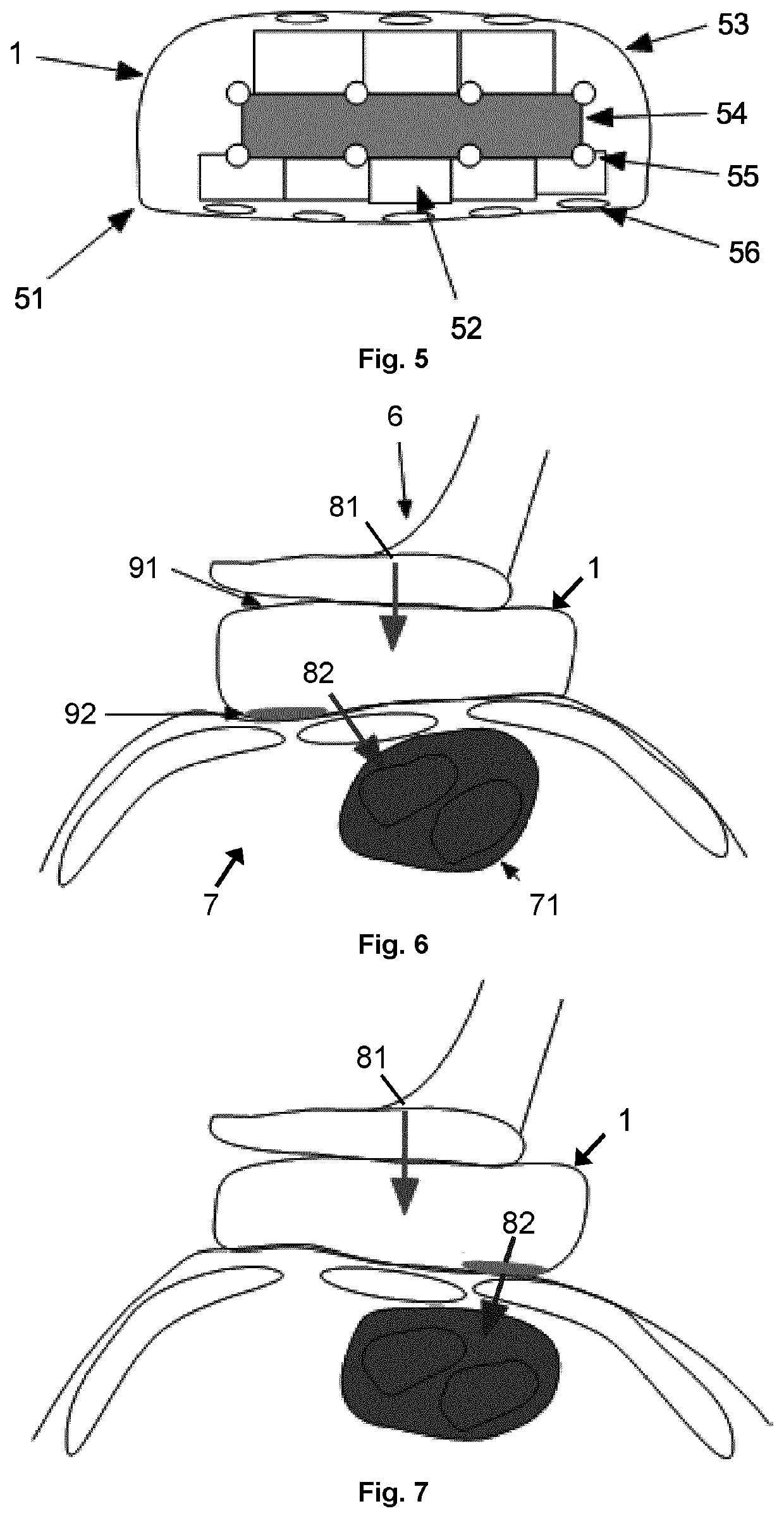 Cardiopulmonary resuscitation device, control, method and computer program