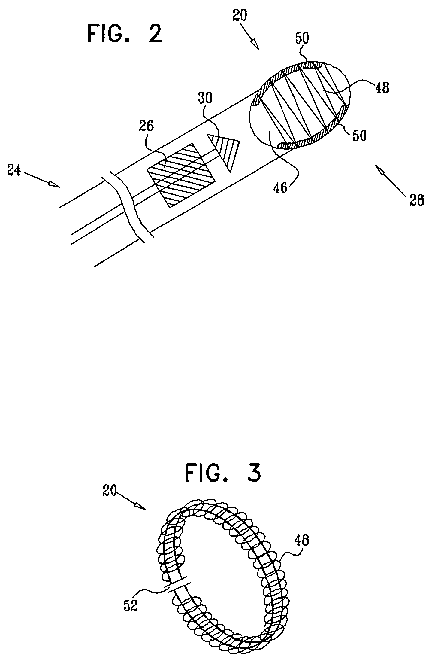 Externally applied RF for pulmonary vein isolation