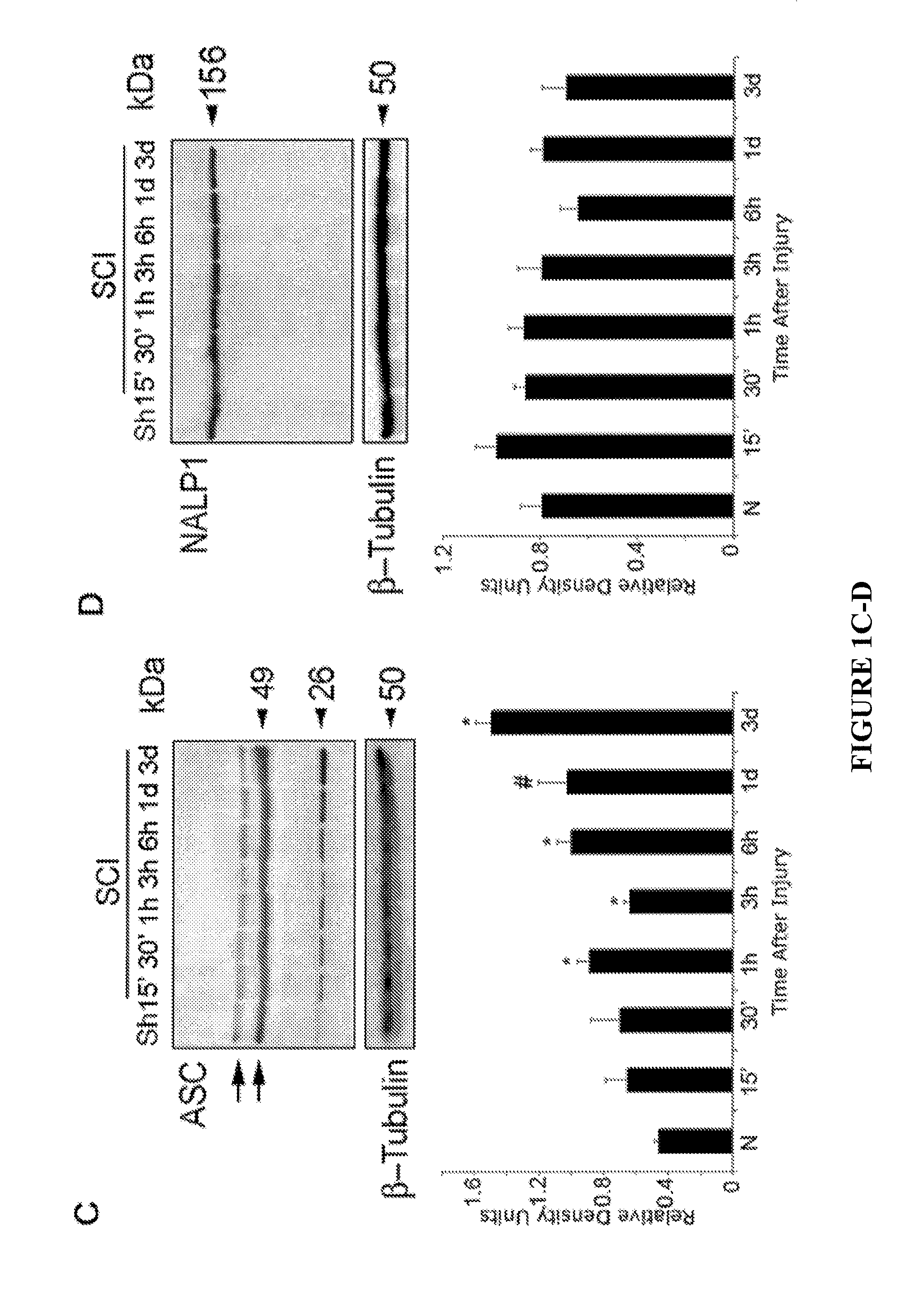 Methods of modulating inflammasome activity to treat inflammatory conditions