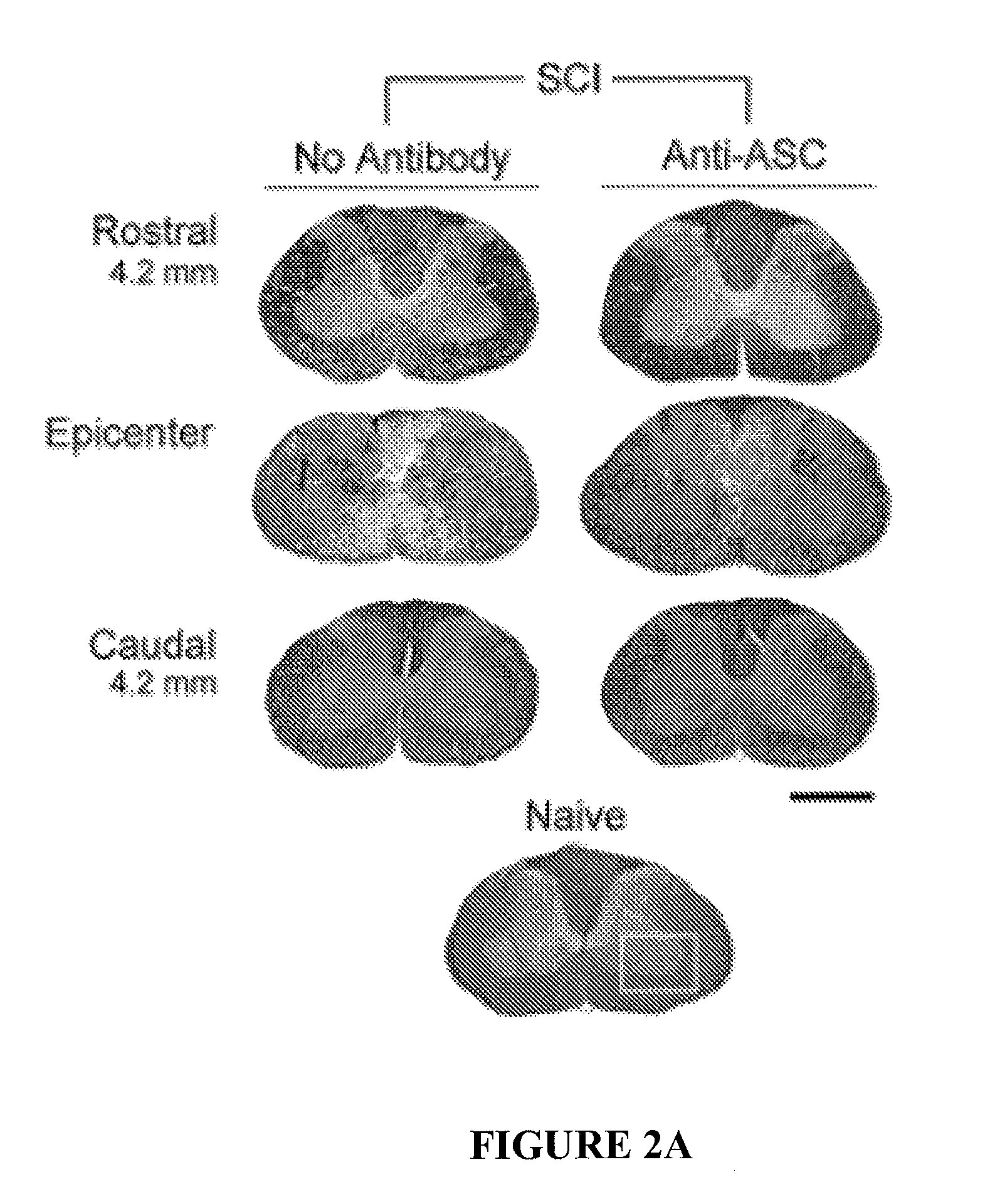 Methods of modulating inflammasome activity to treat inflammatory conditions