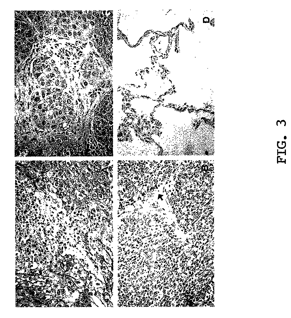 Targeting of Notch3 receptor function for cancer therapy