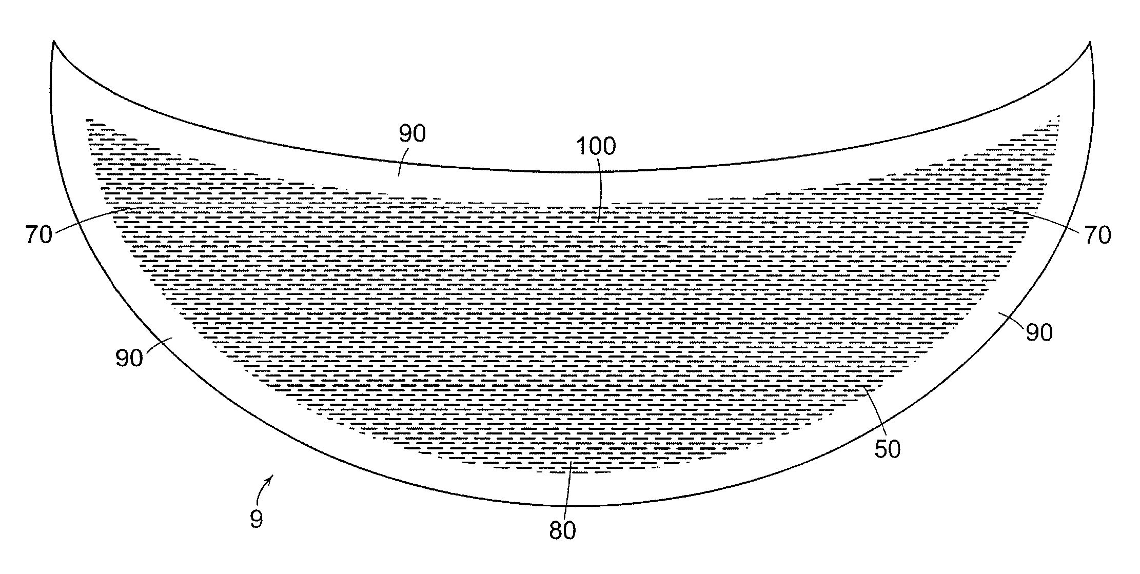 Mastopexy and Breast Reconstruction Prostheses and Method