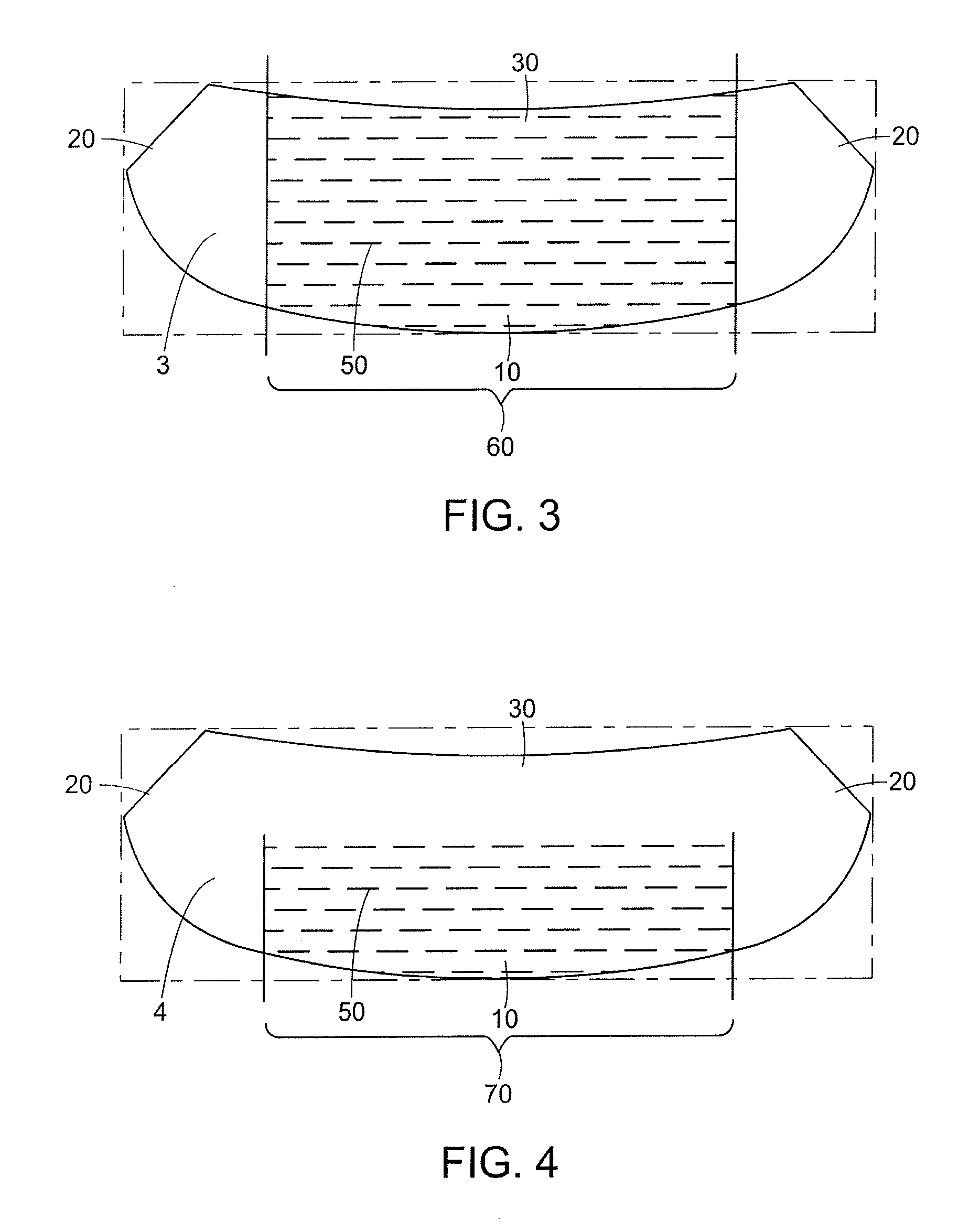 Mastopexy and Breast Reconstruction Prostheses and Method