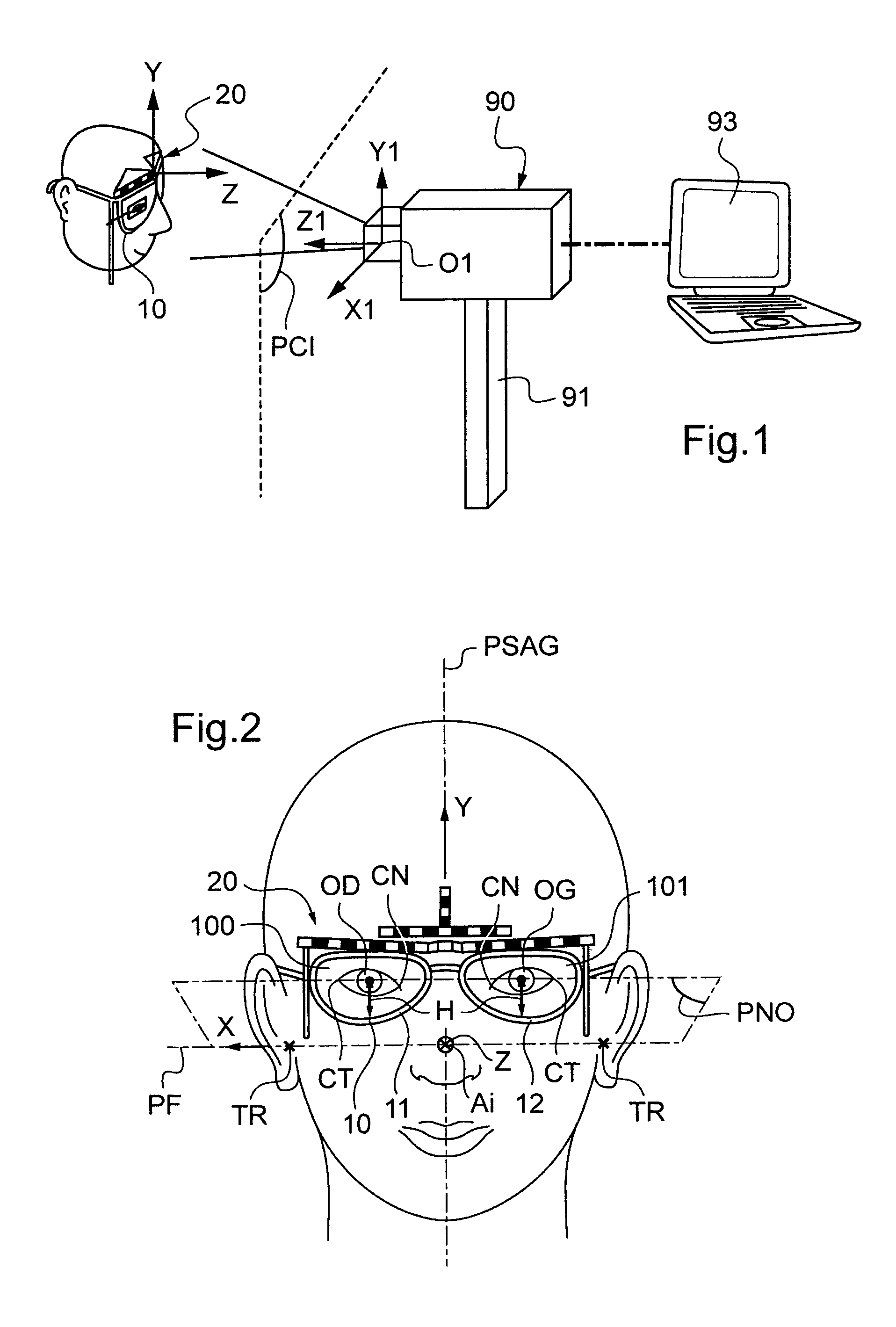 Method for determining at least one geometric postural parameter when fitting a corrective spectacle frame on the face of a wearer in the anatomical posture thereof