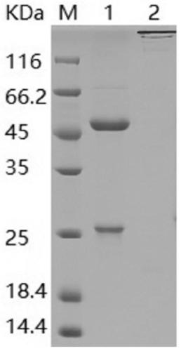 Anti-HPV31L1 monoclonal neutralizing antibodies and application thereof