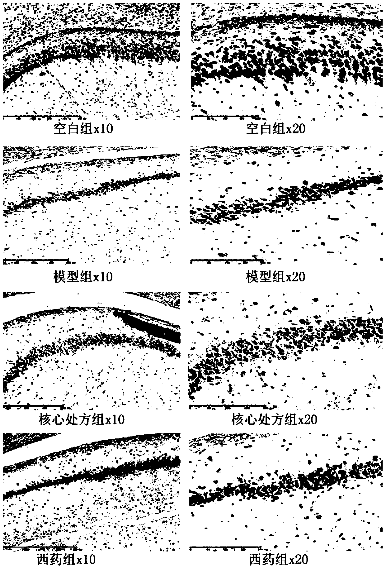 Traditional Chinese medicine composition for promoting regeneration of hippocampal neurons